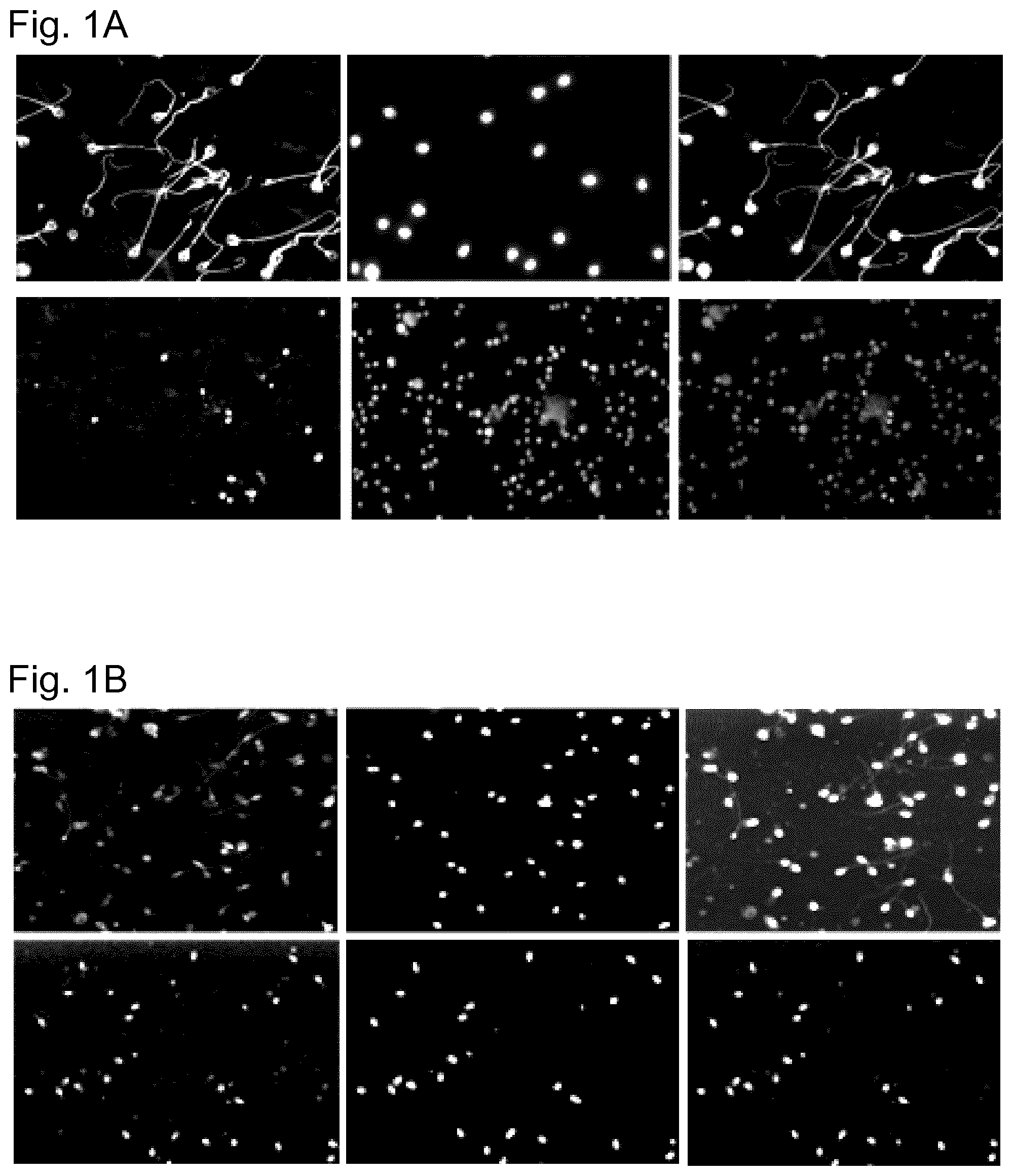 Patent US11774441 — Method for determining the fertility of spermatozoa comprising detection of vimentin variant 3 — Figure 1
