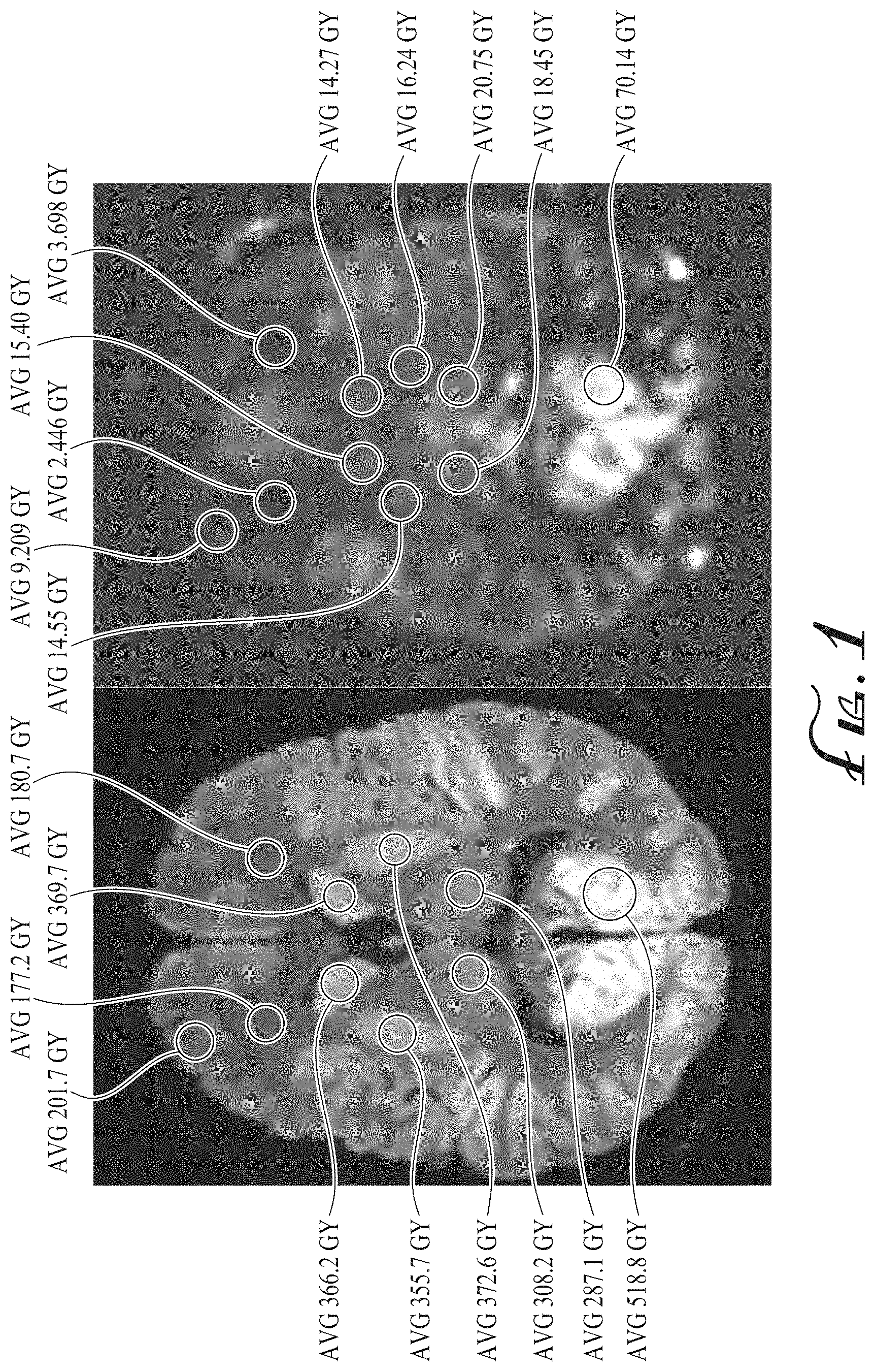 Patent US11774536 Figure 1 – Imaging biomarkers based on ratio between diffusion and perfusion