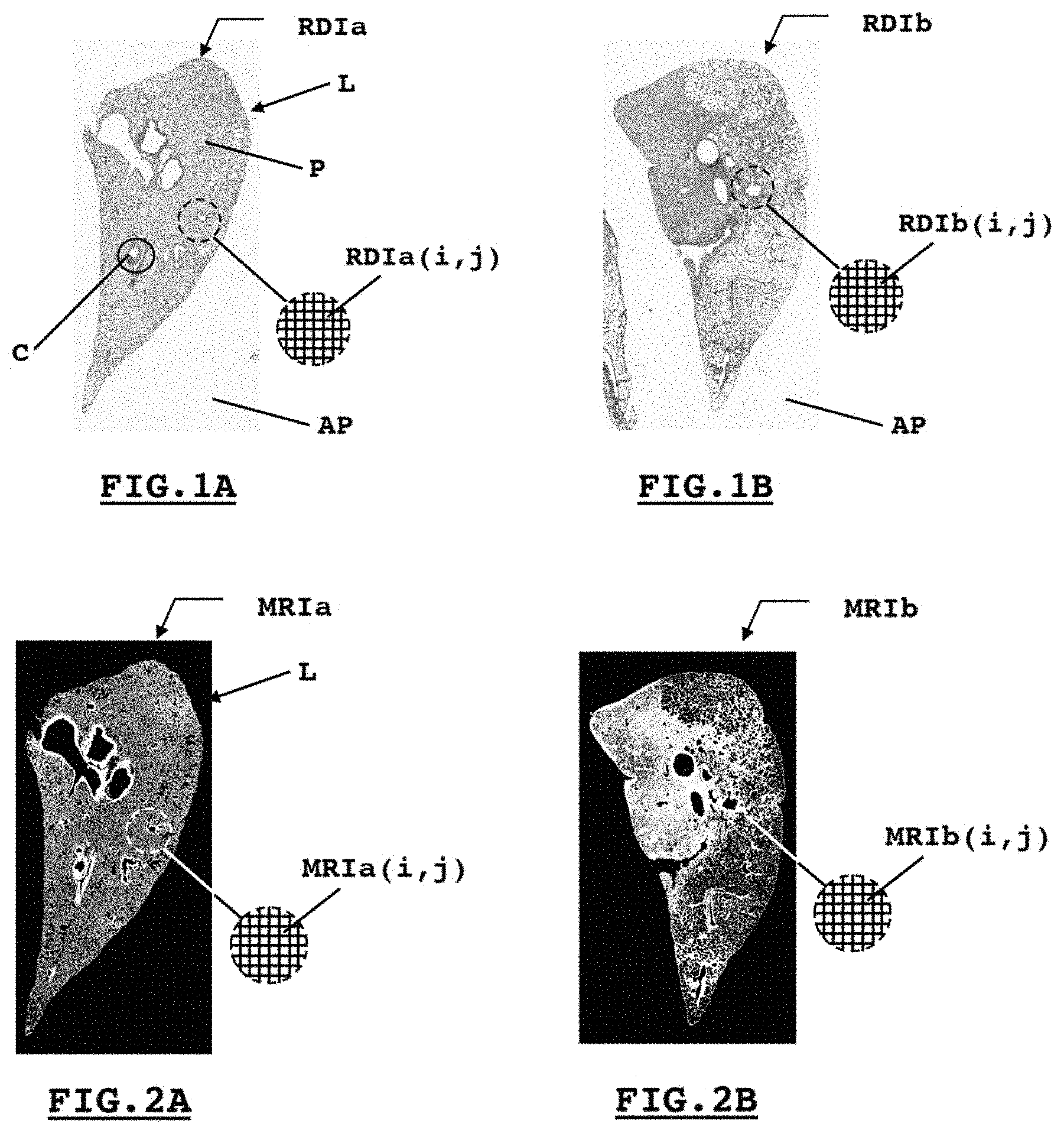 Patent US11776115 — System and method for estimating a quantity of interest based on an image of a histological section — Figure 1