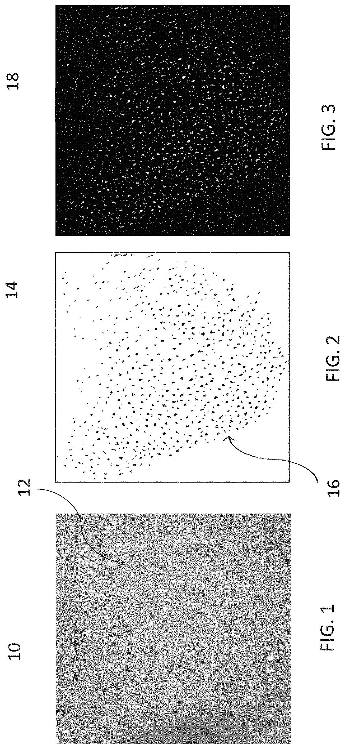 Patent US11776161 — Methods for identifying pore color — Figure 1