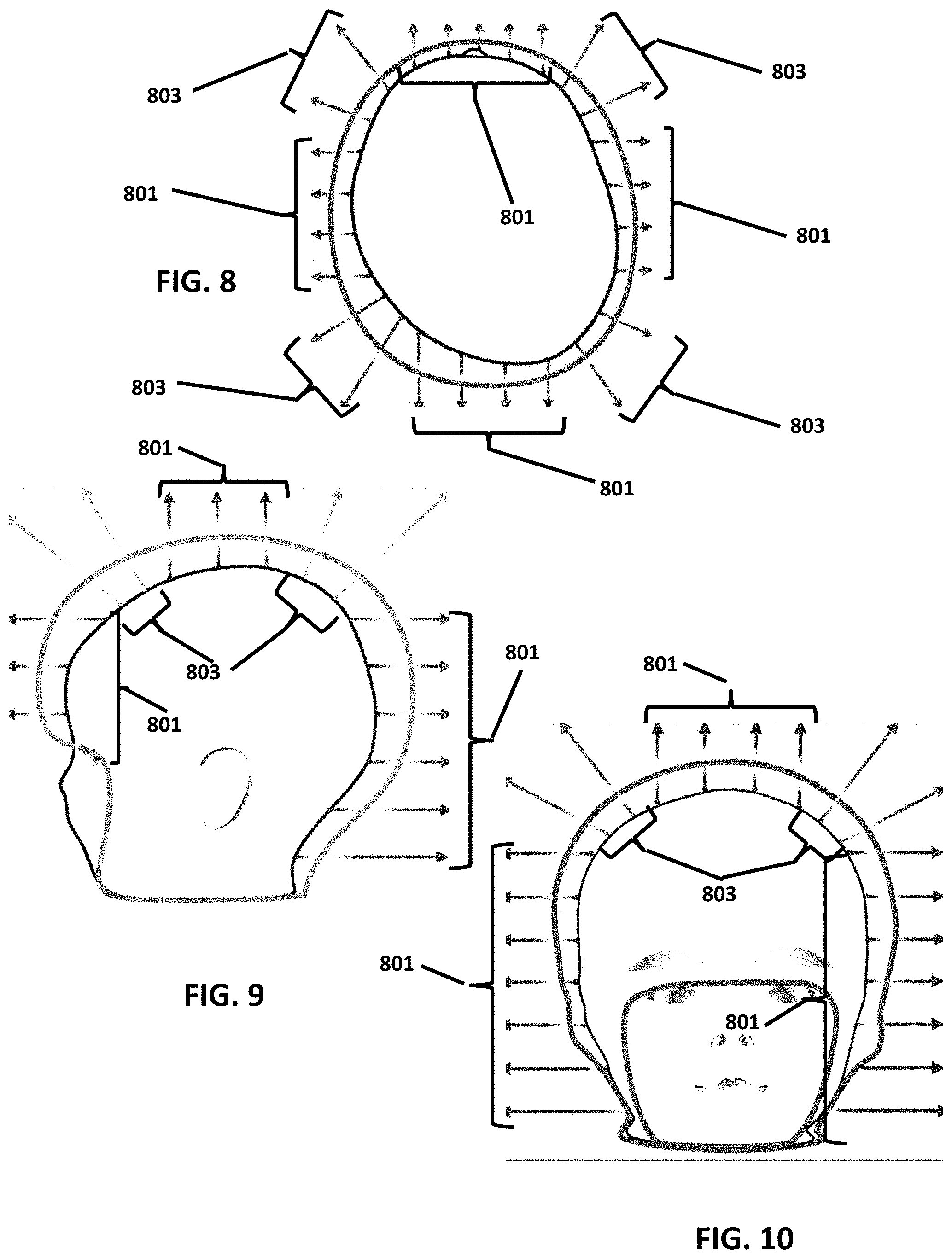 Patent US11776228 Figure 5 – Point of service manufacturing method for custom cranial remodeling device