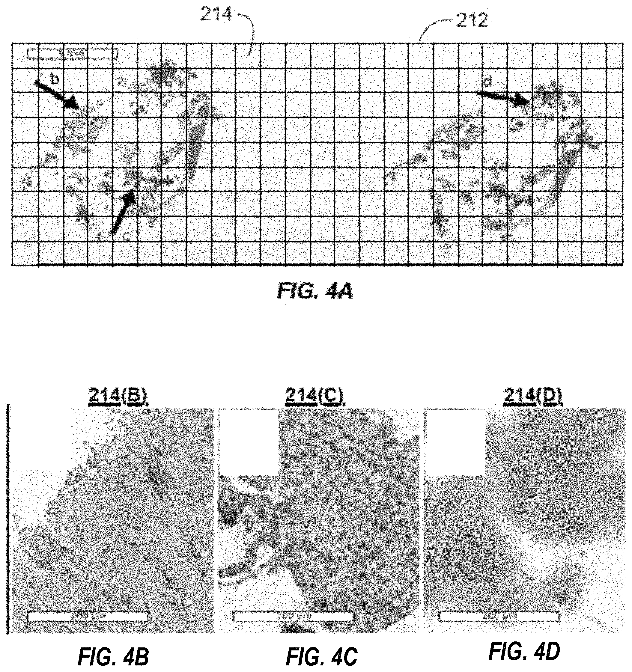 Patent US11776235 Figure 7 – System, method and computer-accessible medium for quantification of blur in digital images