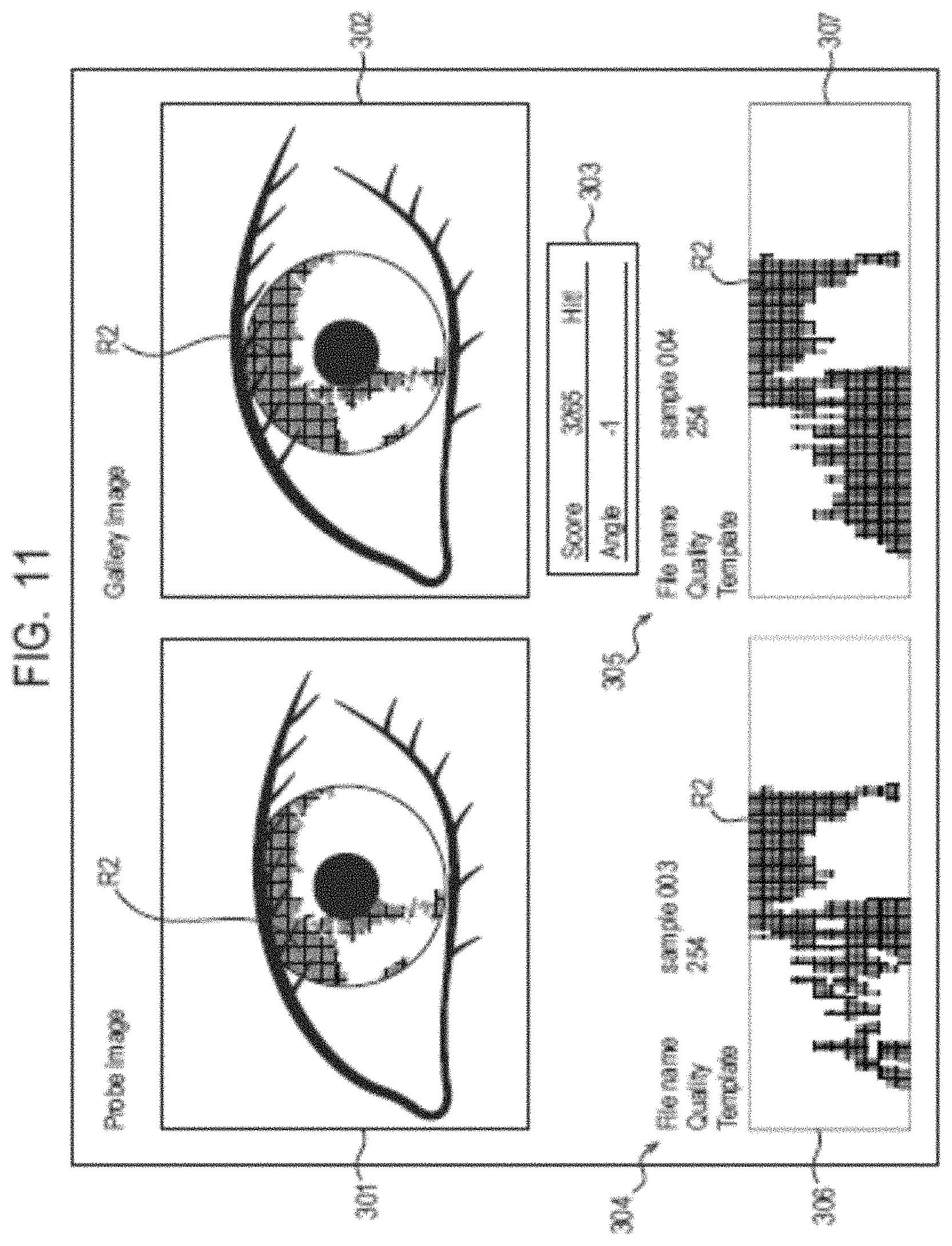 Patent US11776316 Figure 11 – Information processing system, information processing method, and storage medium