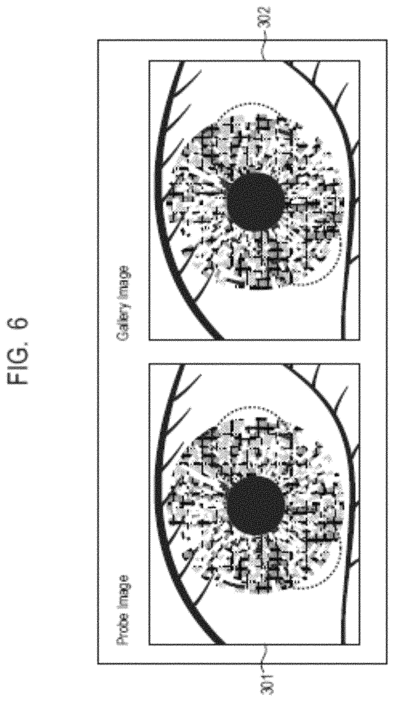 Patent US11776318 Figure 6 – Information processing system, information processing method, and storage medium
