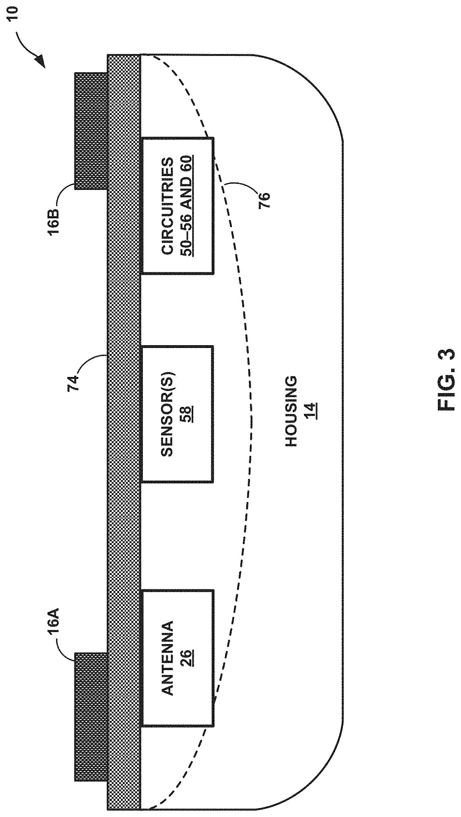 Patent US11776691 Figure 3 – Machine learning based depolarization identification and arrhythmia localization visualization