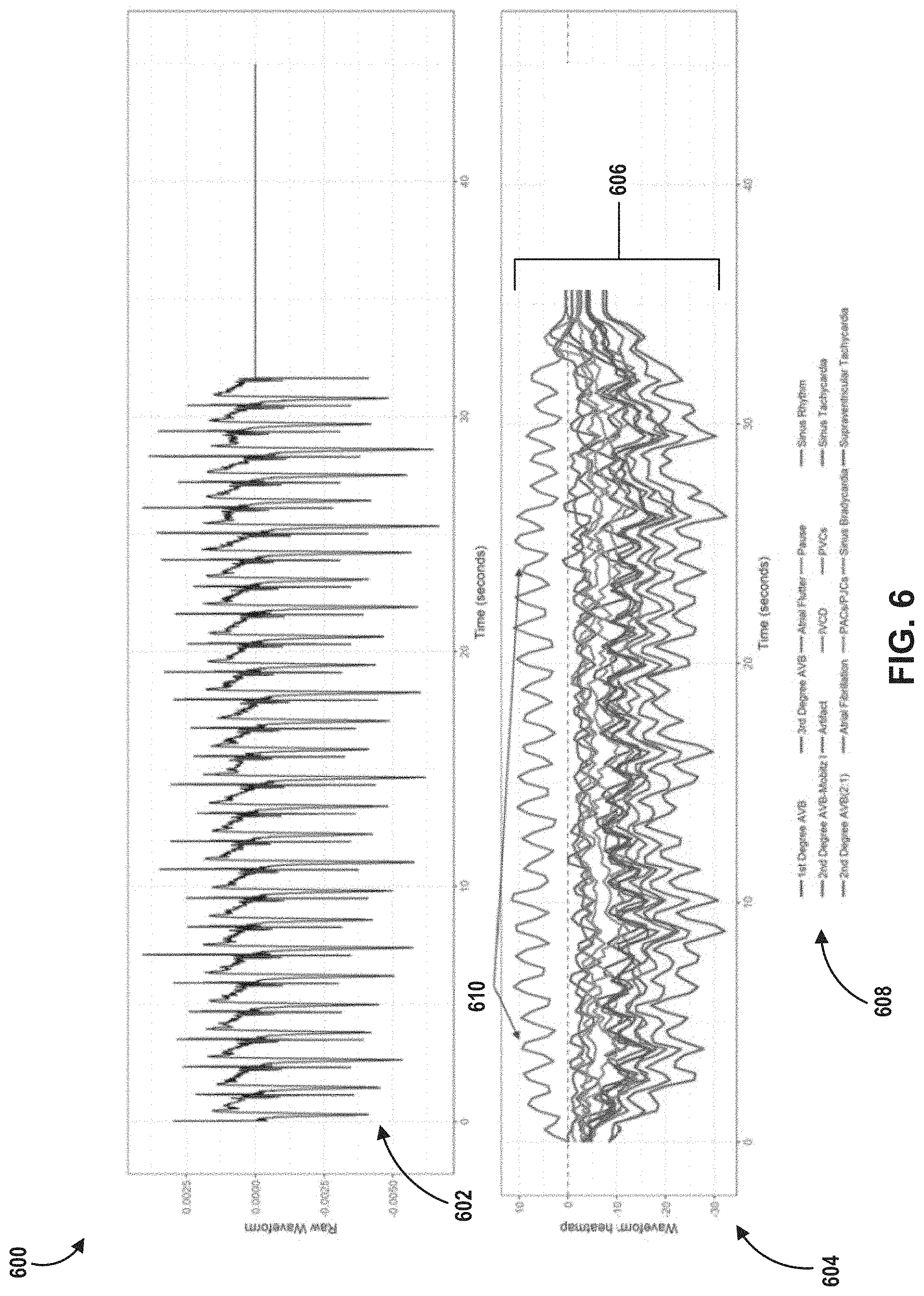 Patent US11776691 Figure 6 – Machine learning based depolarization identification and arrhythmia localization visualization