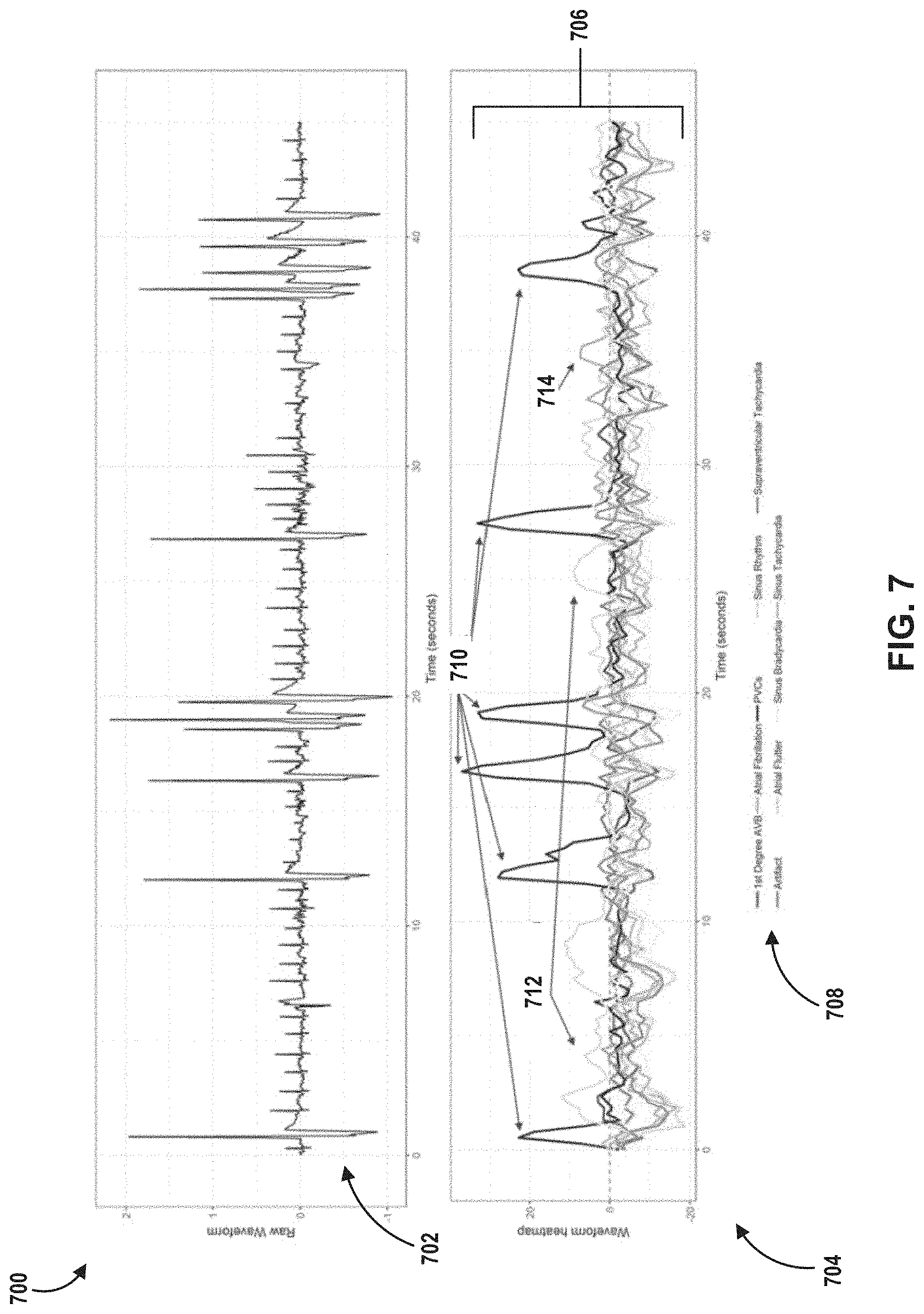 Patent US11776691 Figure 7 – Machine learning based depolarization identification and arrhythmia localization visualization