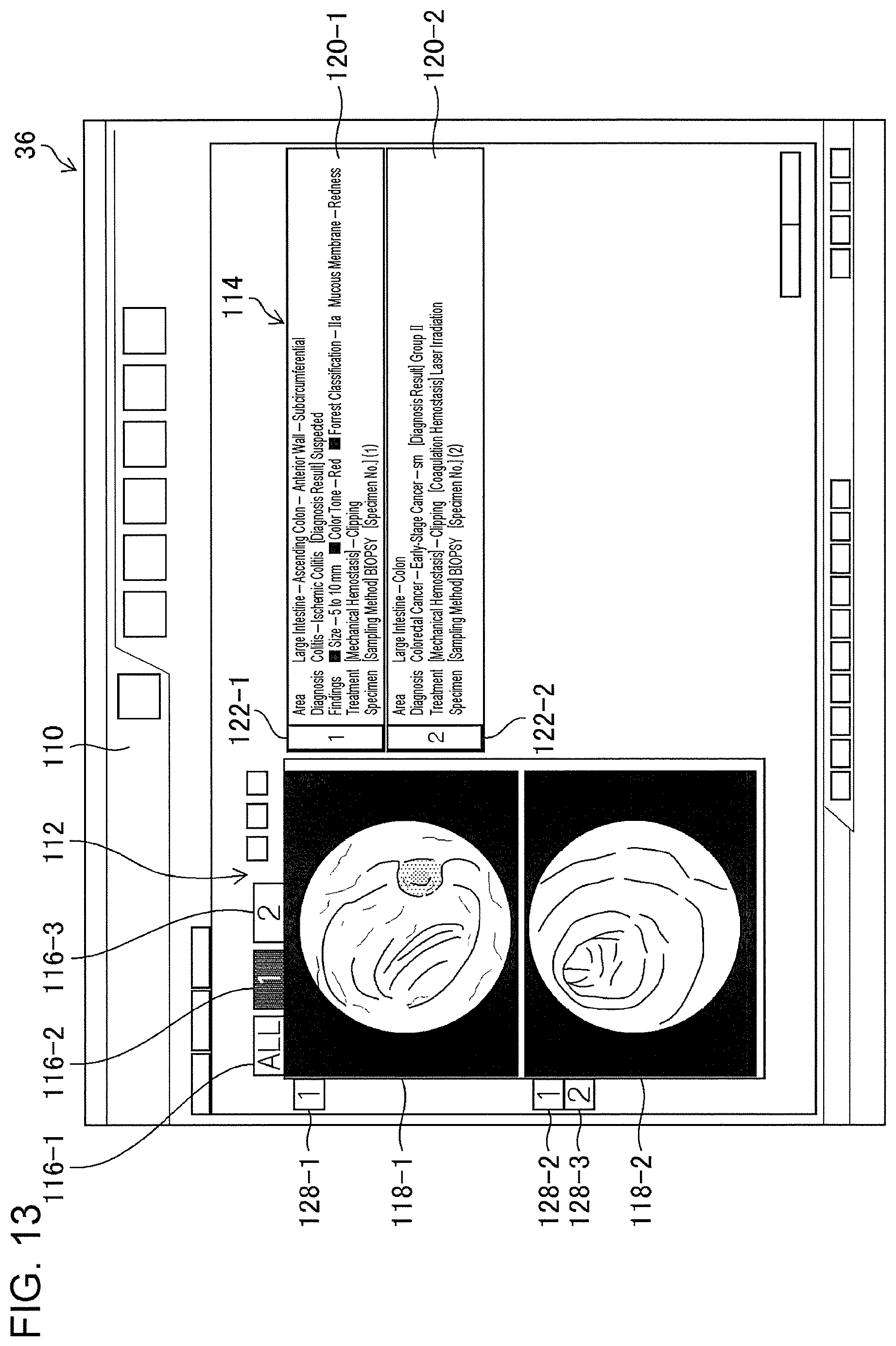 Patent US11776692 Figure 11 – Training data collection apparatus, training data collection method, program, training system, trained model, and endoscopic image processing apparatus