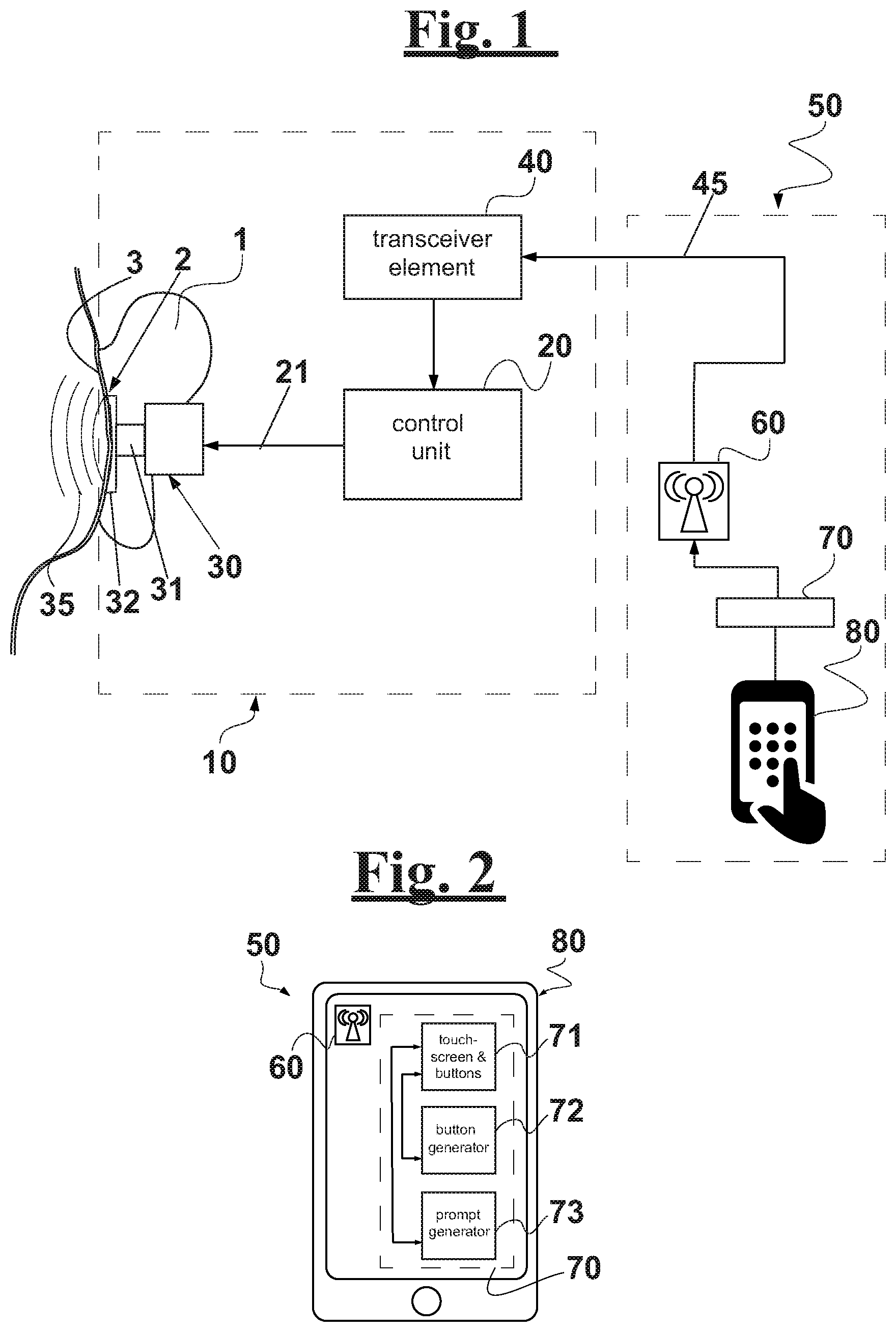 Patent US11778396 — Electromechanical stimulation system for treating tinnitus — Figure 1