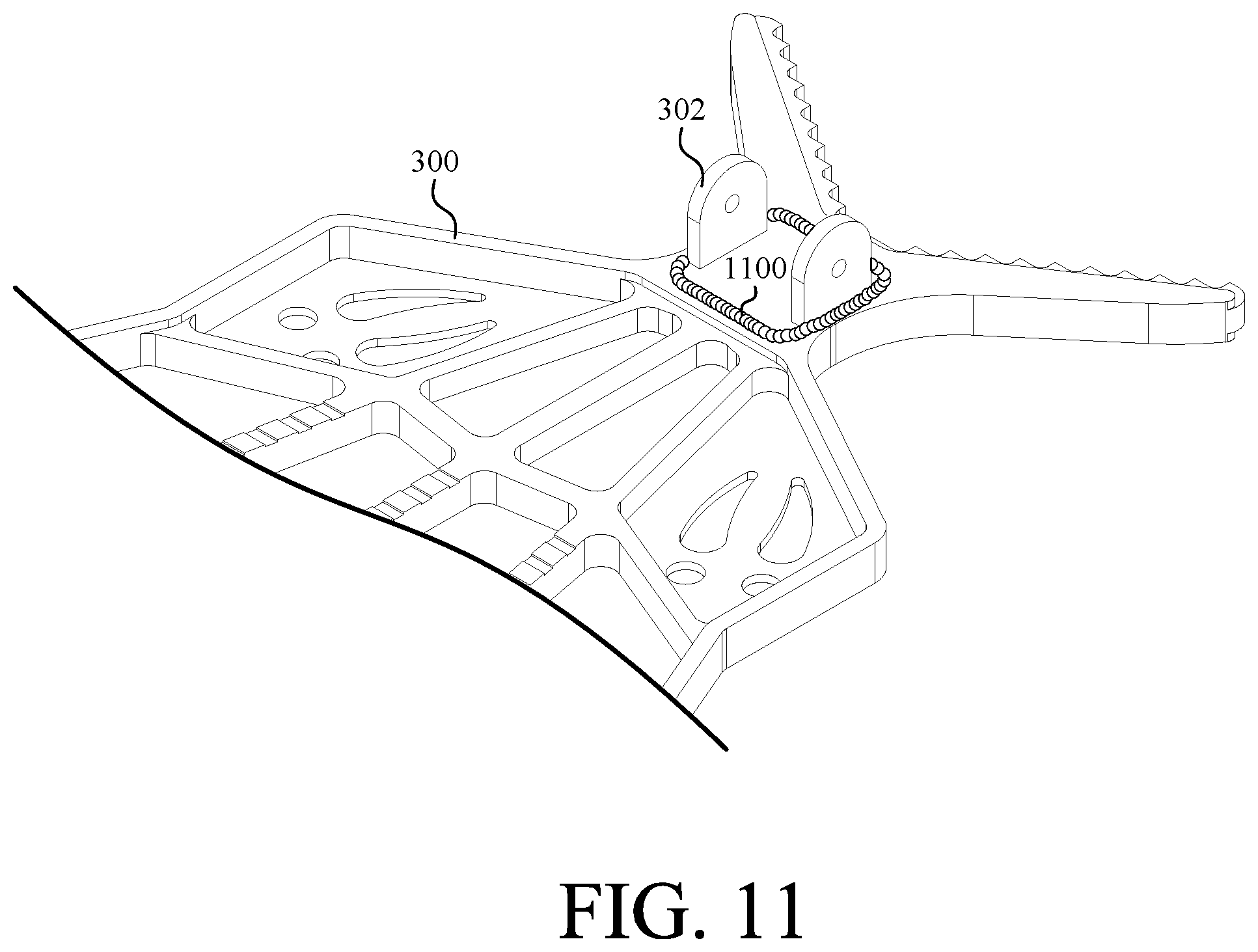 Patent US11779009 Figure 12 – Portable treestand and climbing stick system