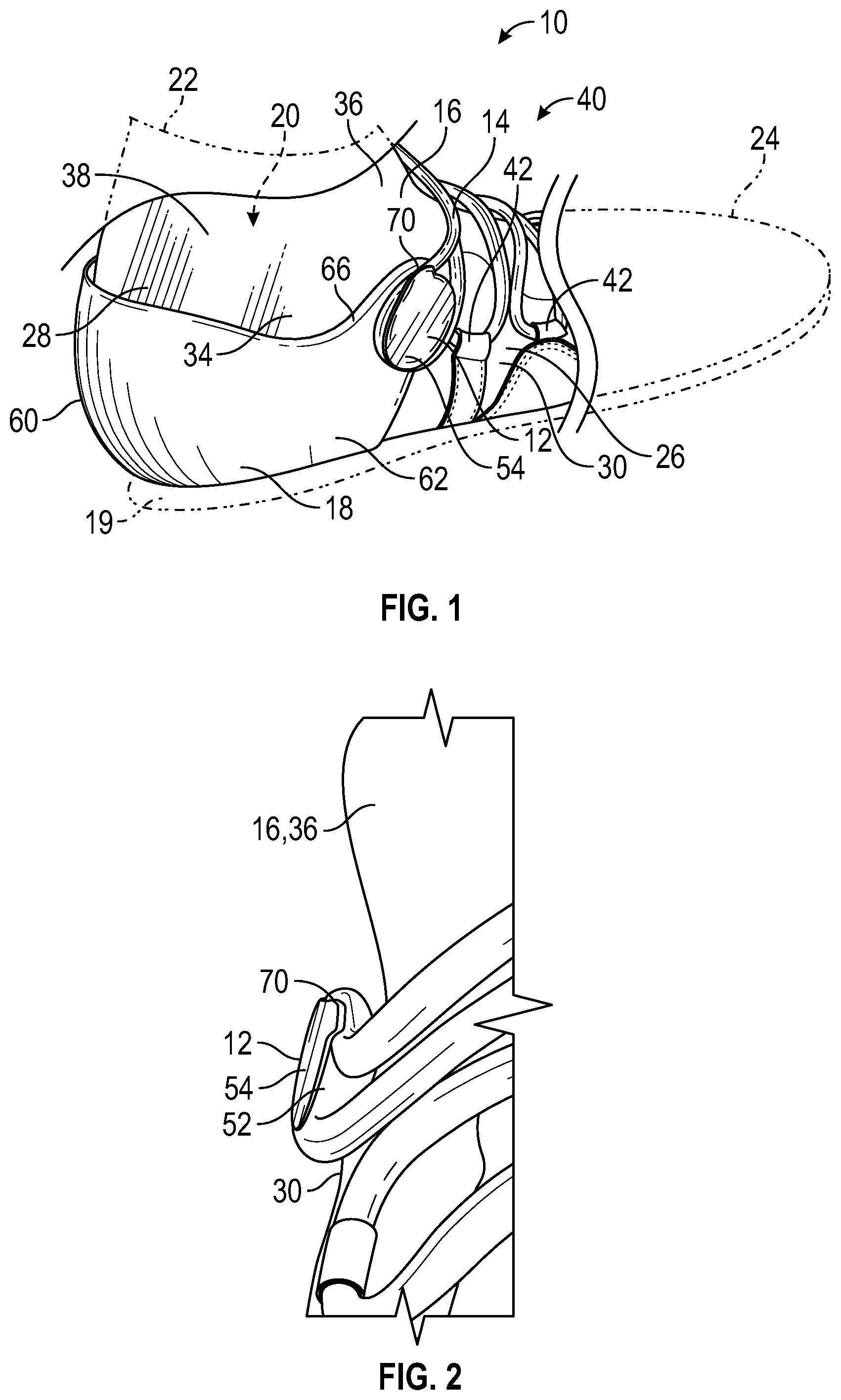 Patent US11779082 — Lace guide for an article of footwear — Figure 1
