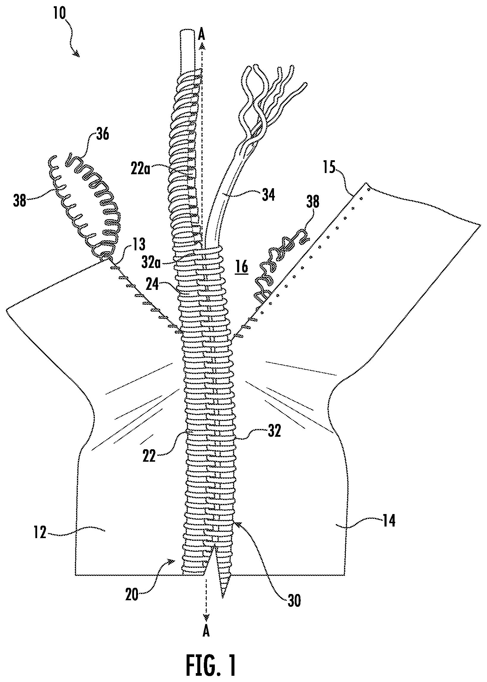 Patent US11779086 — Flame and heat-resistant fastener chain and methods of manufacturing the same — Figure 1