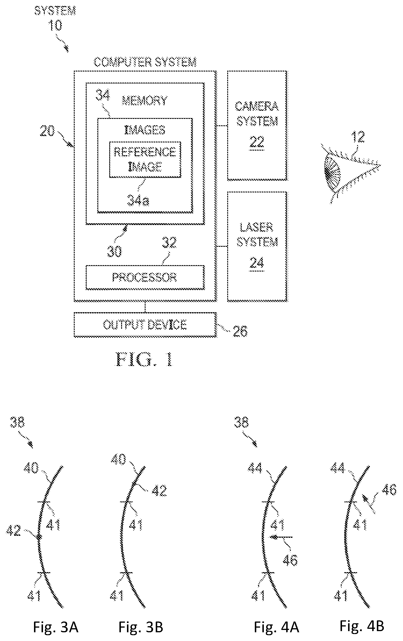 Patent US11779208 — Tracking movement of an eye within a tracking range — Figure 1
