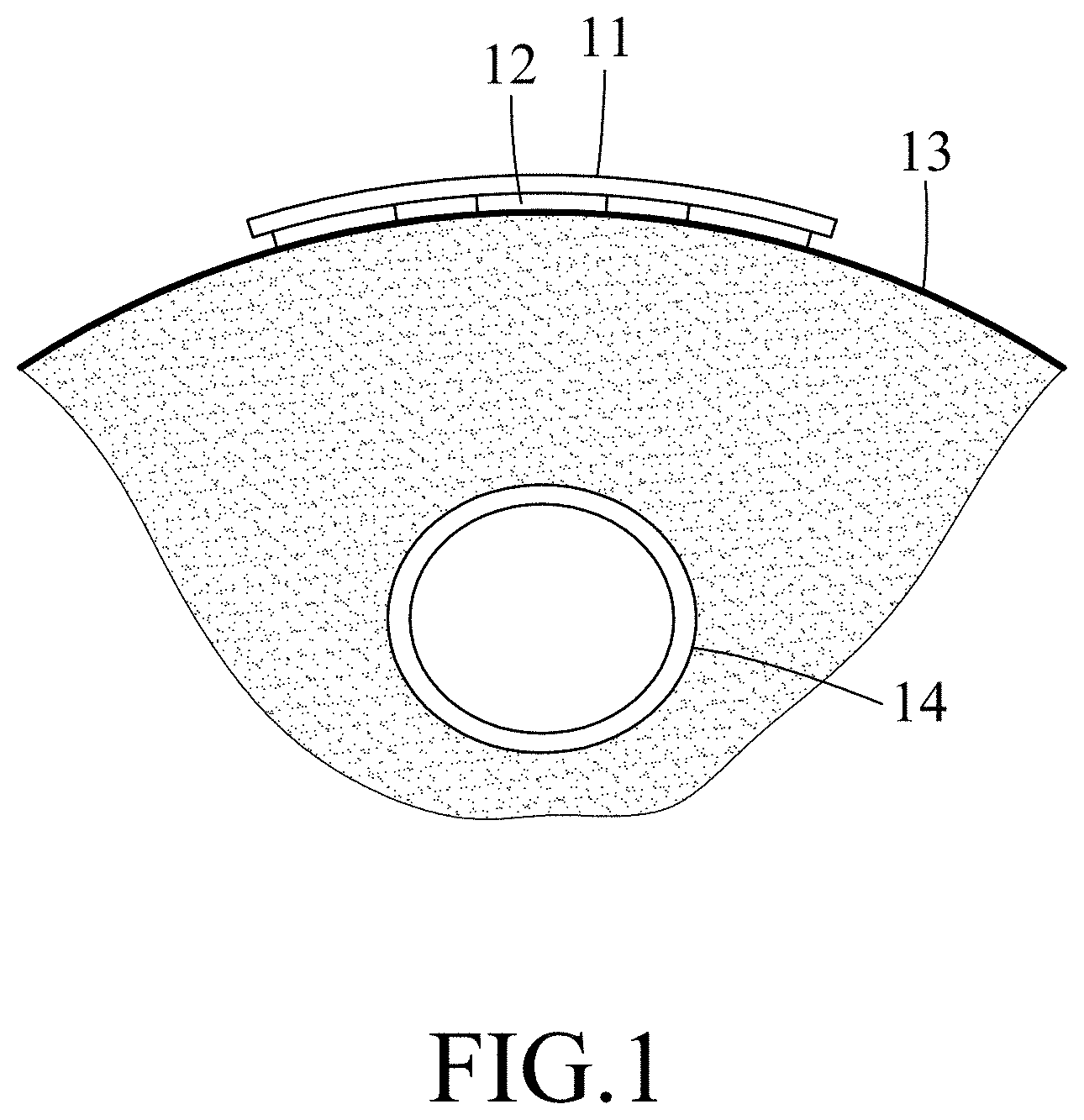 Patent US11779236 — Vascular assessment device — Figure 1