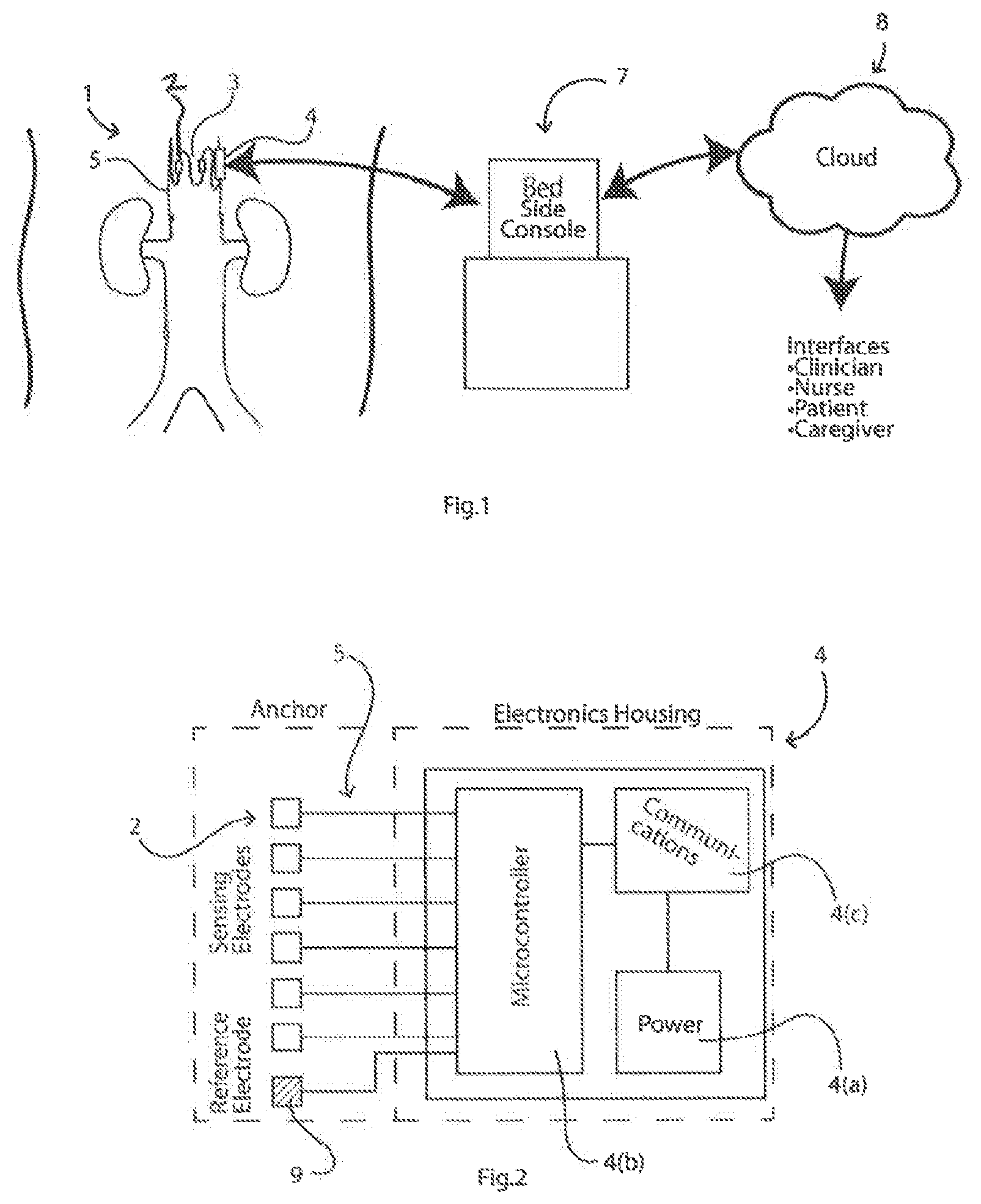 Patent US11779238 Figure 1 – Implantable sensors for vascular monitoring