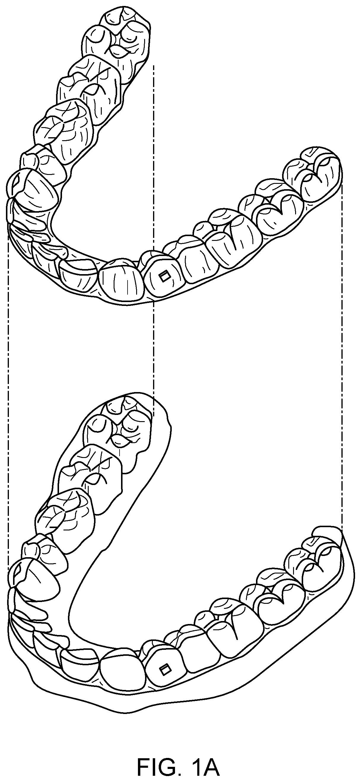 Patent US11779243 — Customized aligner change indicator — Figure 1