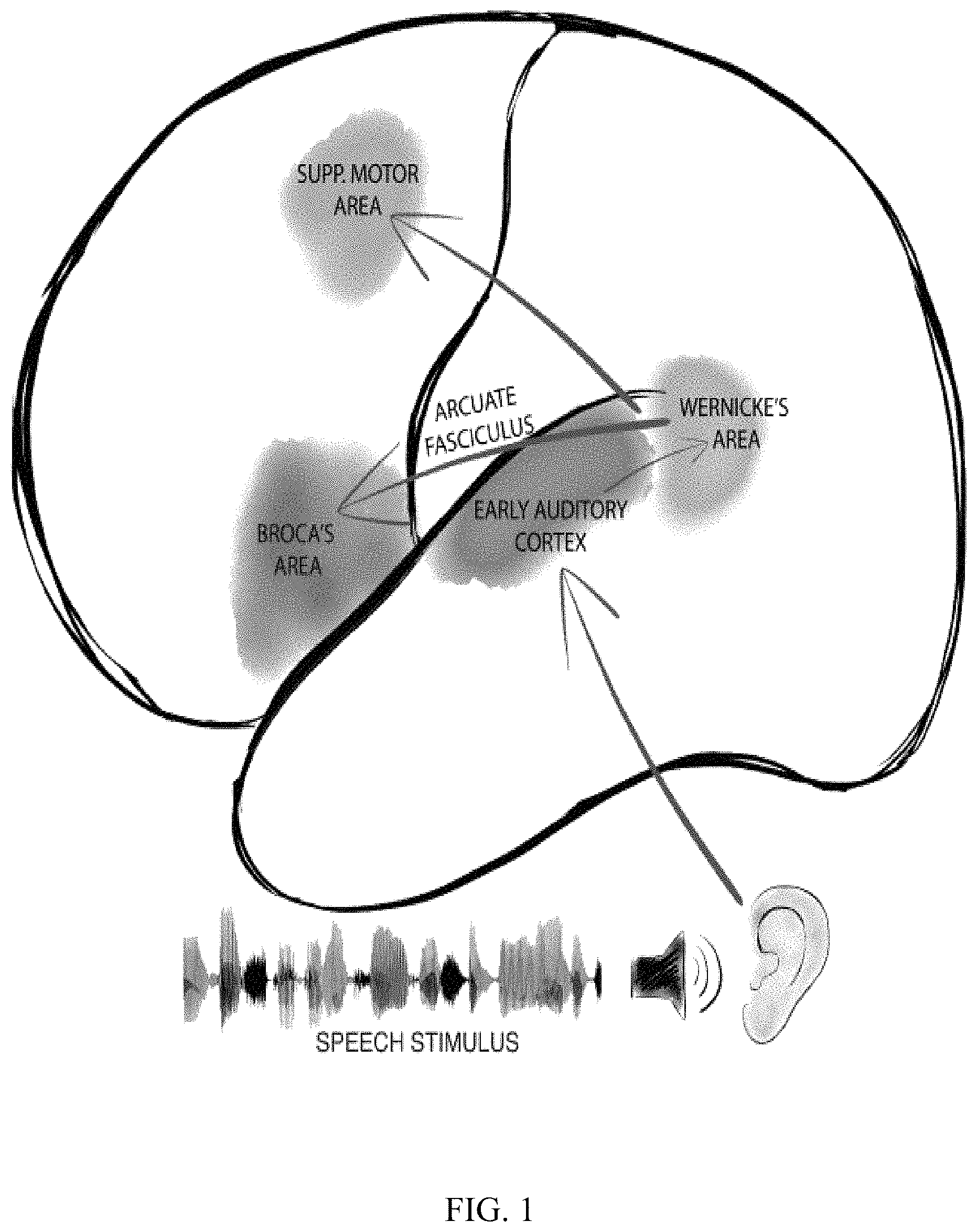 Patent US11779256 Figure 1 – Rapid mapping of language function and motor function without subject participation