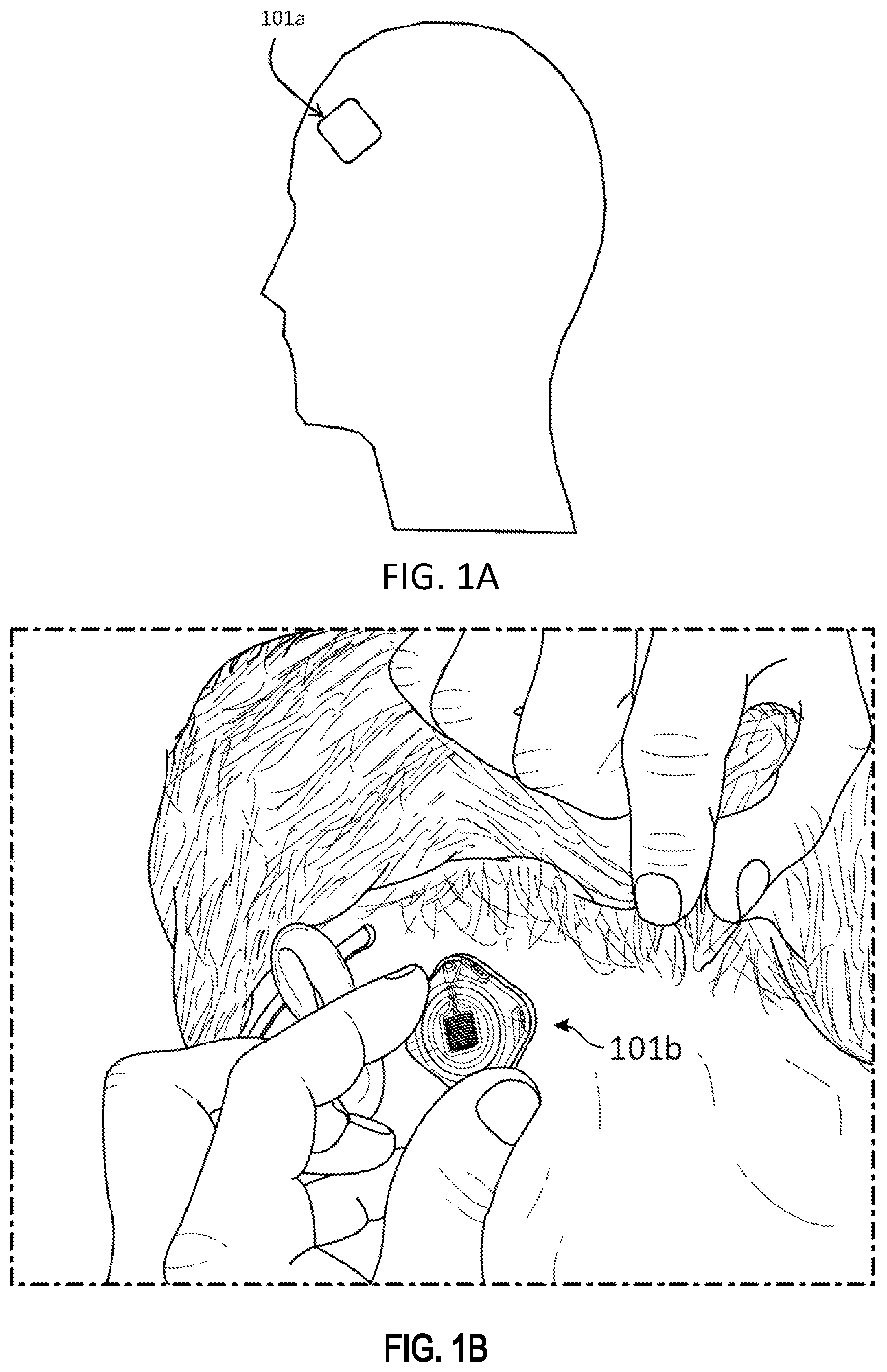 Patent US11779262 — EEG recording and analysis — Figure 1