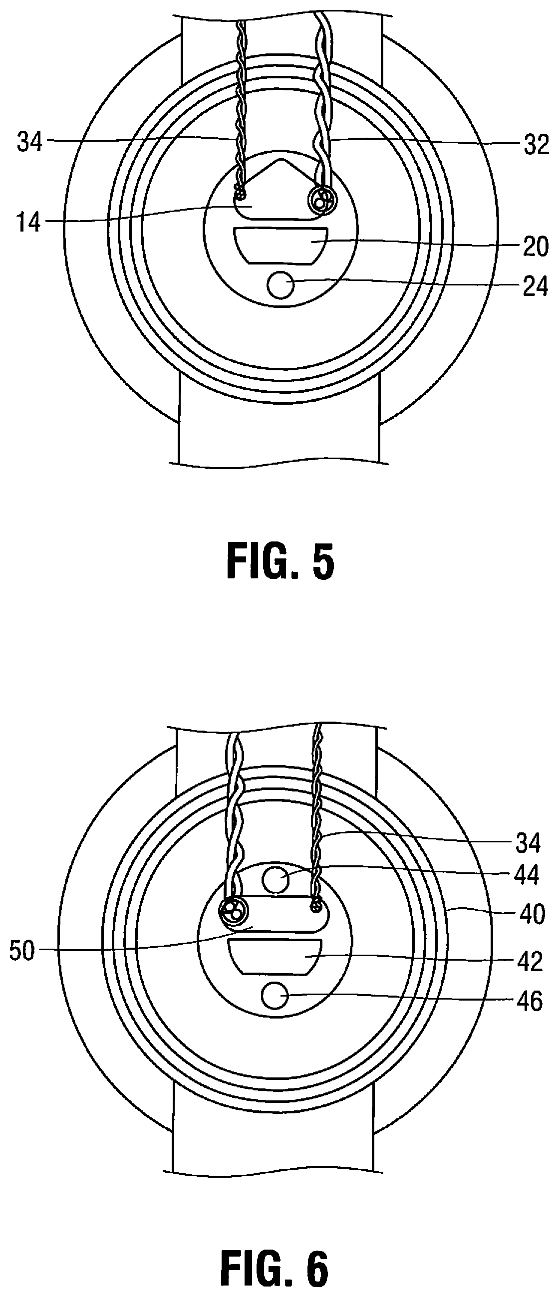 Patent US11779263 Figure 4 – Catheter for monitoring intra-abdominal pressure for assessing preeclampsia