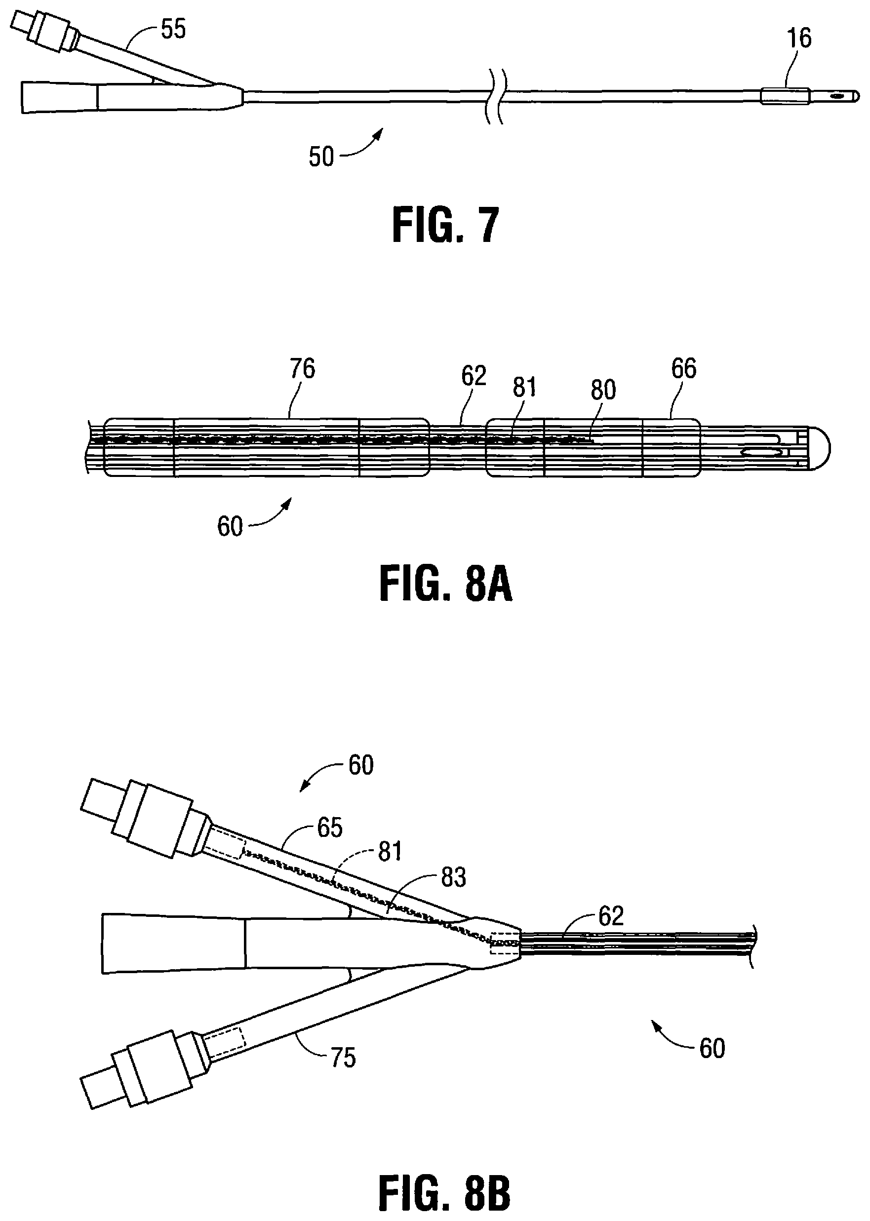 Patent US11779263 Figure 5 – Catheter for monitoring intra-abdominal pressure for assessing preeclampsia