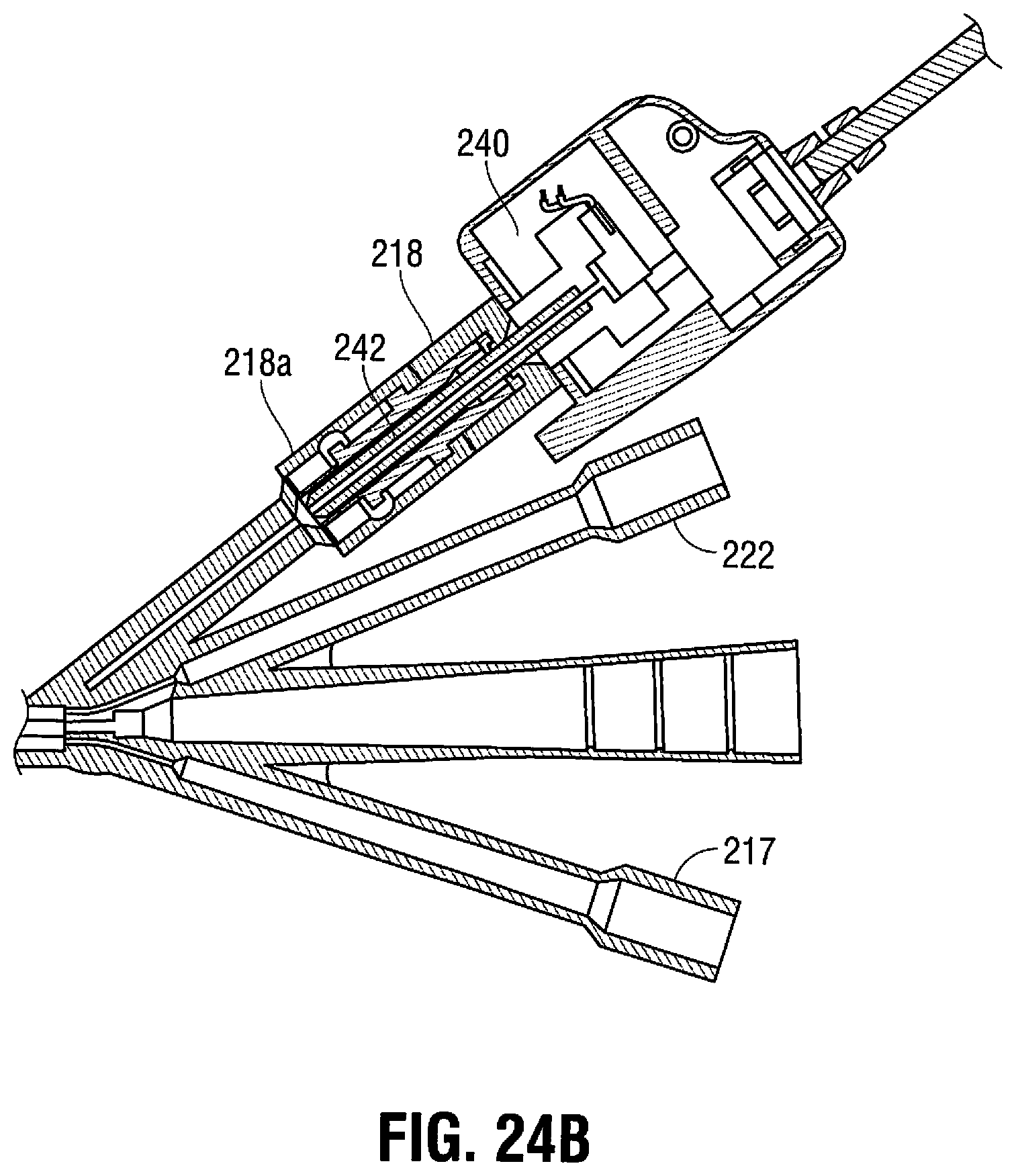 Patent US11779263 Figure 20 – Catheter for monitoring intra-abdominal pressure for assessing preeclampsia