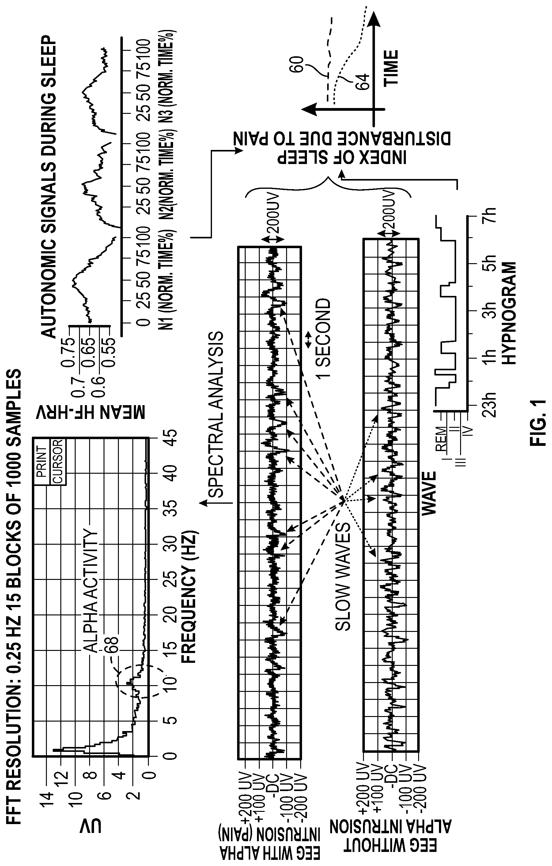 Patent US11779267 — Macro/micro-structure of sleep and similar states of consciousness to optimize pain treatment — Figure 1