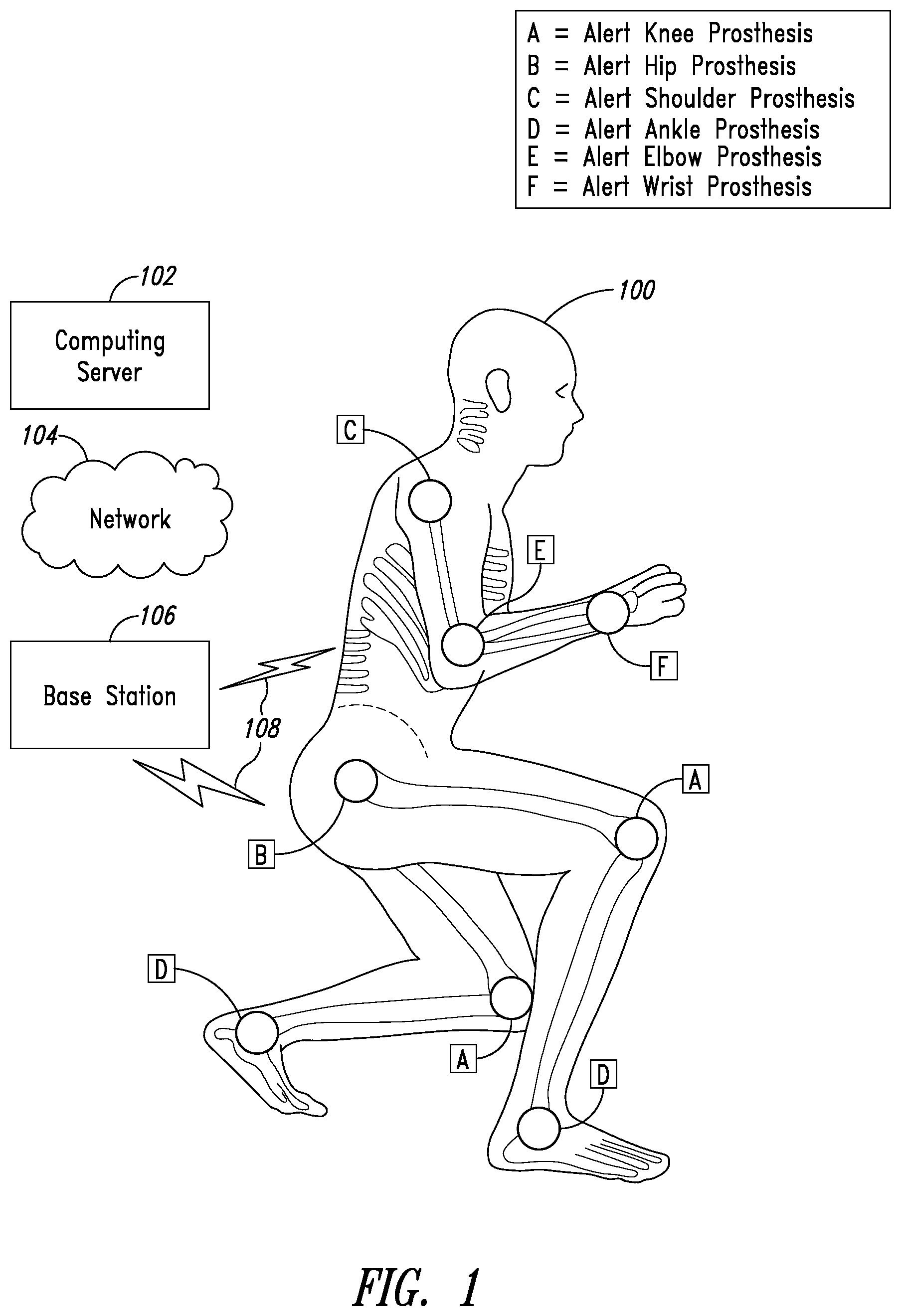 Patent US11779273 — Implantable reporting processor for an alert implant — Figure 1
