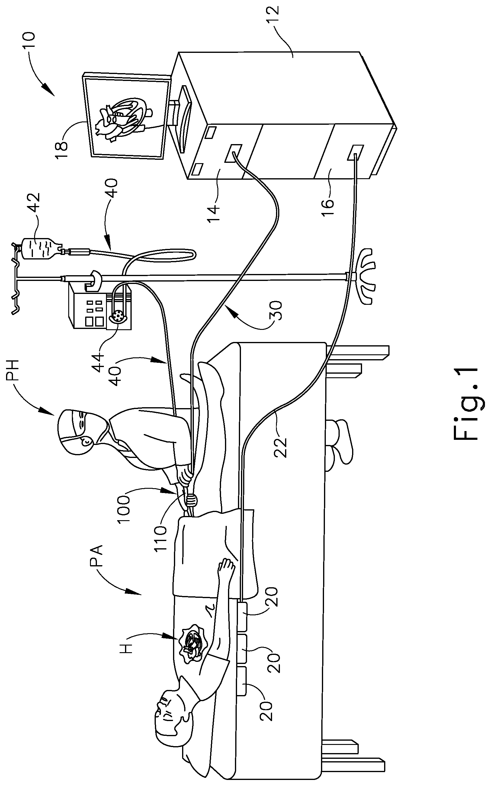Patent US11779280 — Reference wires to remove noise and artifacts in cardiac mapping catheter — Figure 1