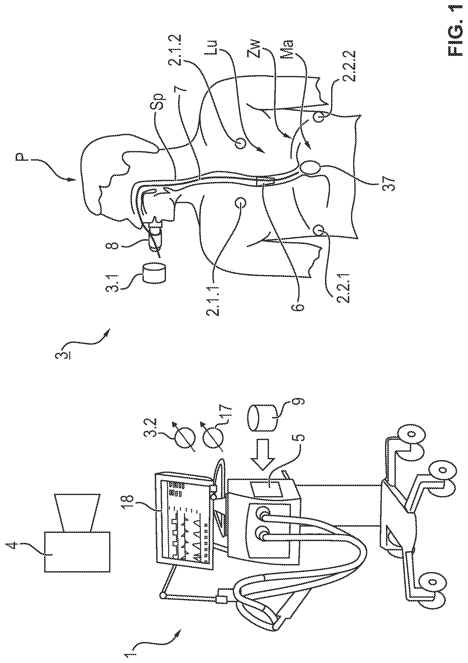 Patent US11779283 Figure 1 – Process and signal processing unit for determining a cardiogenic signal