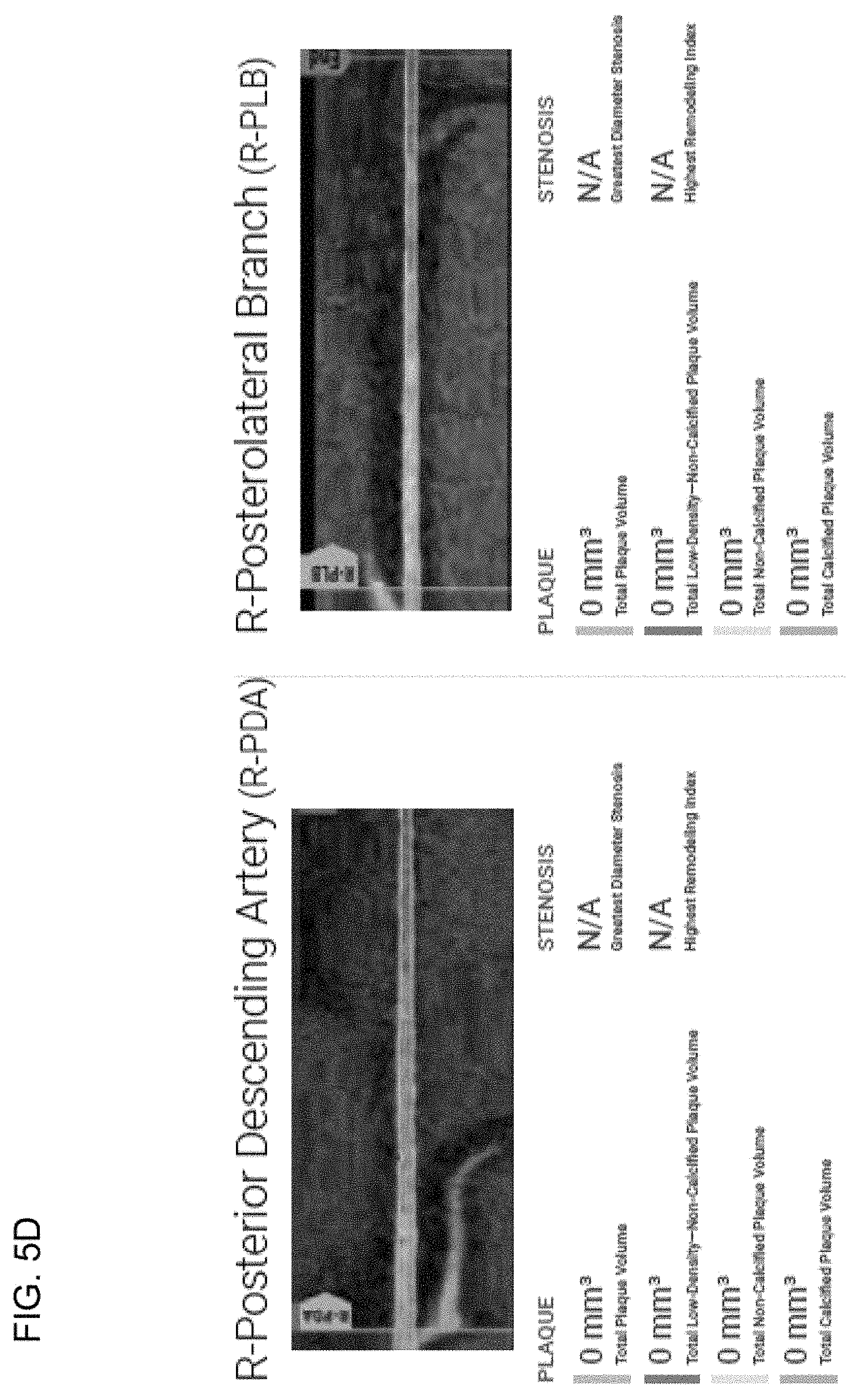 Patent US11779292 Figure 14 – Systems, methods, and devices for medical image analysis, diagnosis, risk stratification, decision making and/or disease tracking