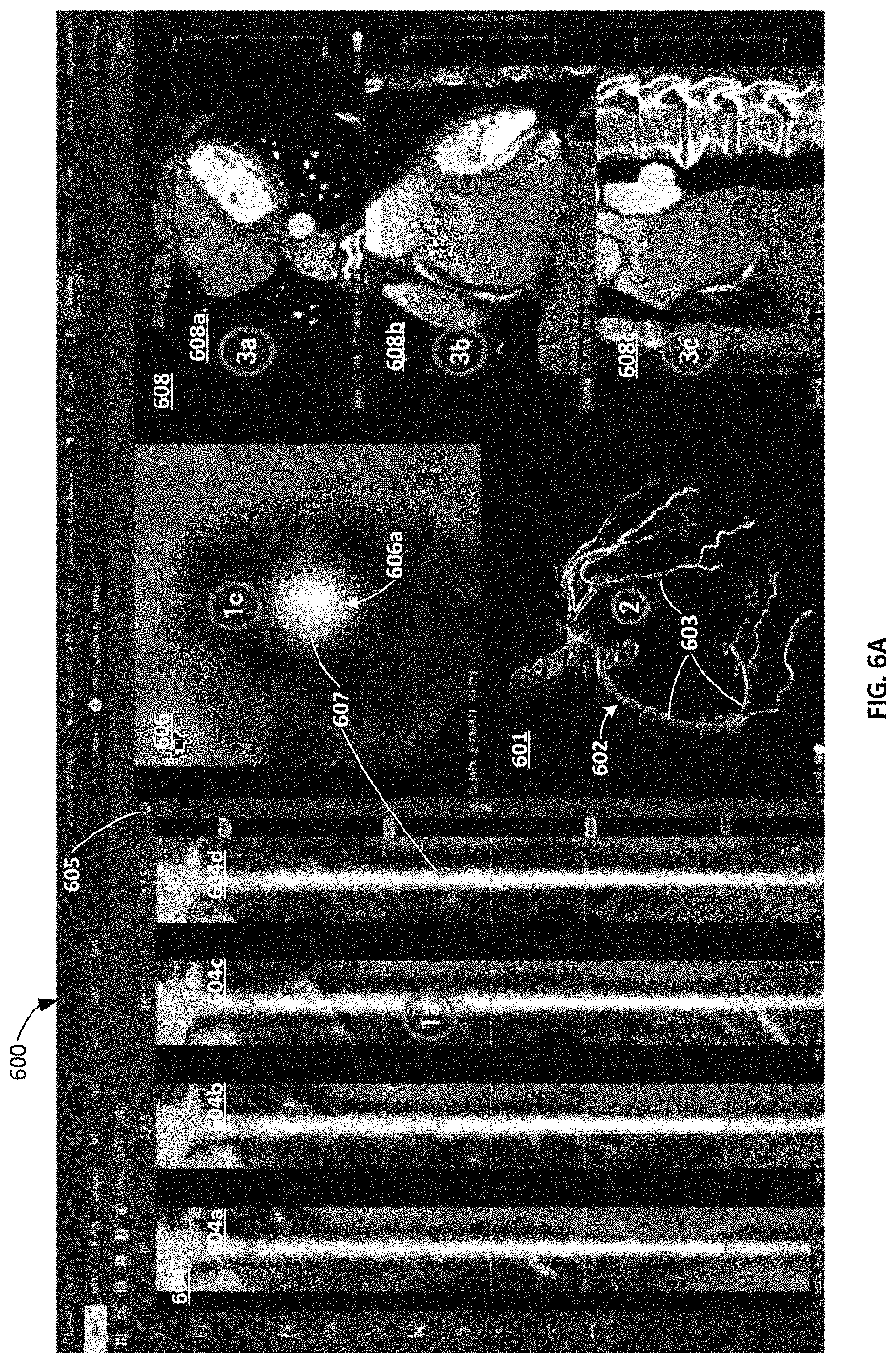 Patent US11779292 Figure 20 – Systems, methods, and devices for medical image analysis, diagnosis, risk stratification, decision making and/or disease tracking