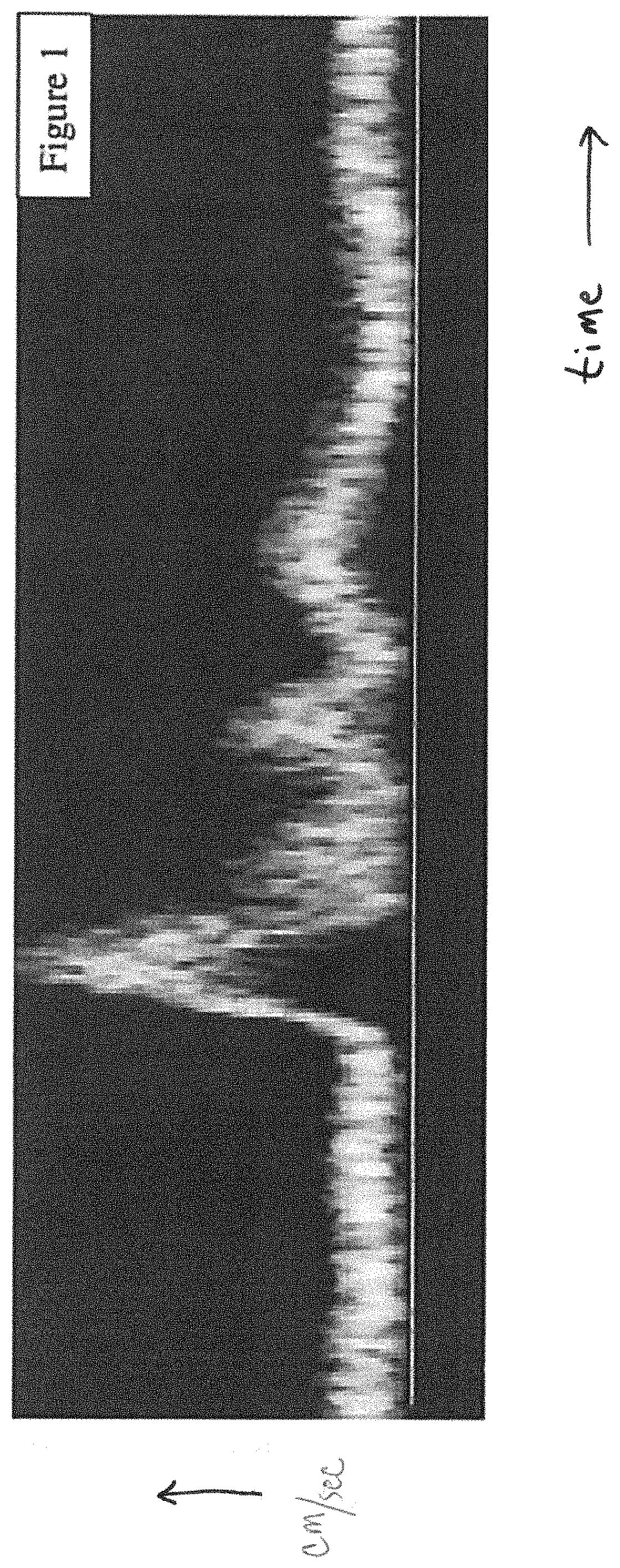 Patent US11779311 — Method and apparatus for performing spectral doppler imaging — Figure 1