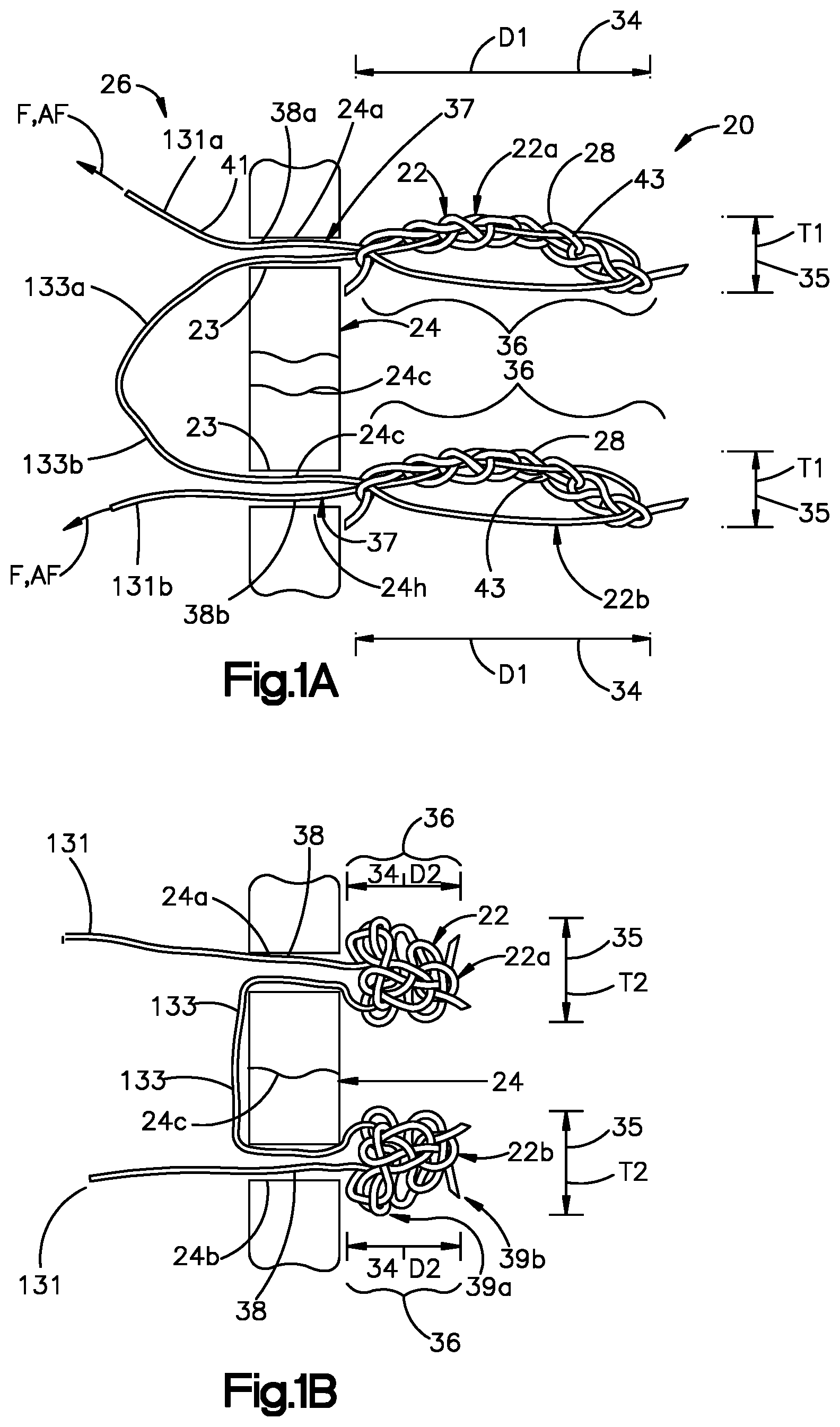 Patent US11779318 — Insertion instrument for anchor assembly — Figure 1