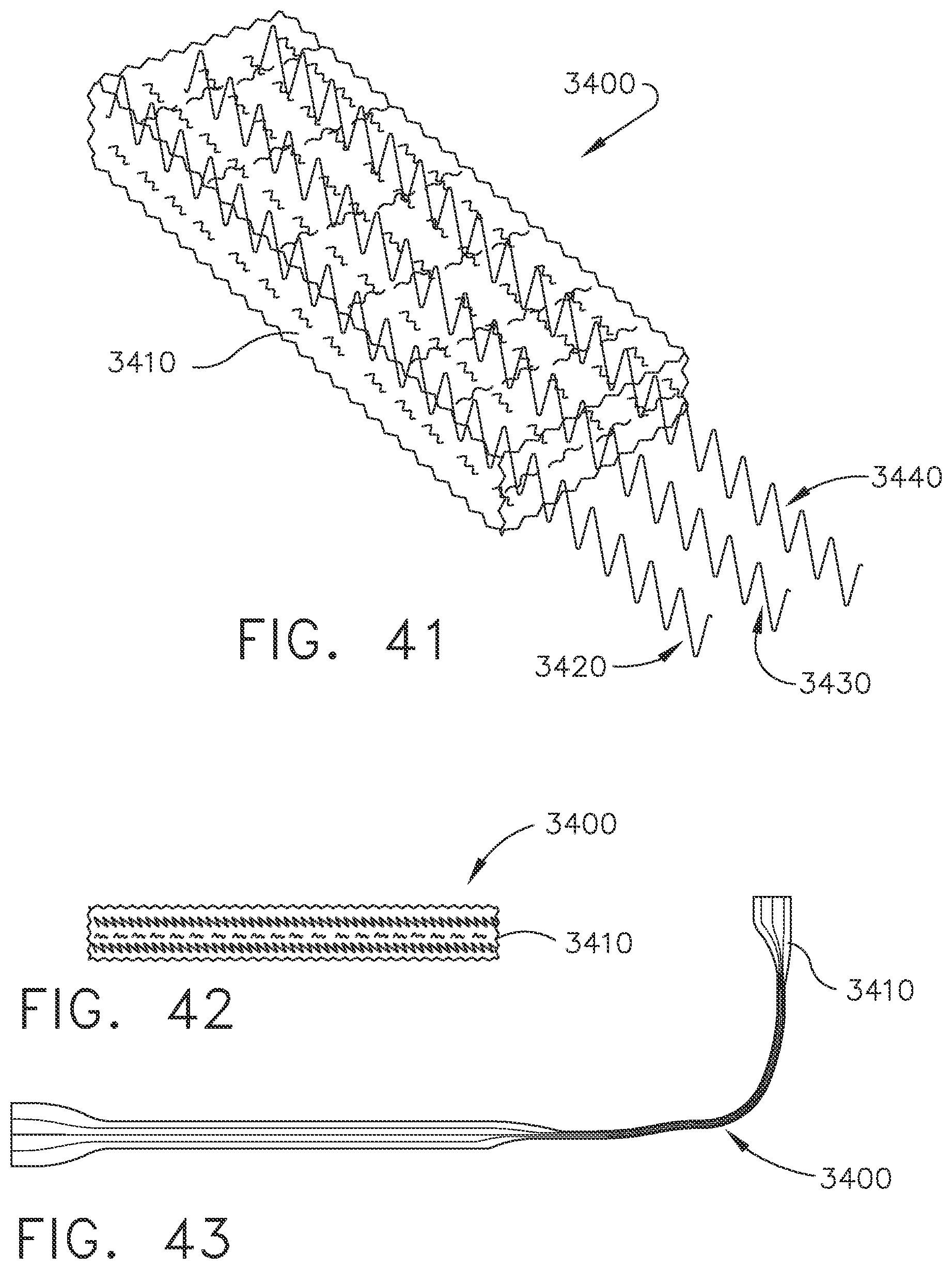 Patent US11779329 Figure 17 – Surgical instrument comprising a flex circuit including a sensor system