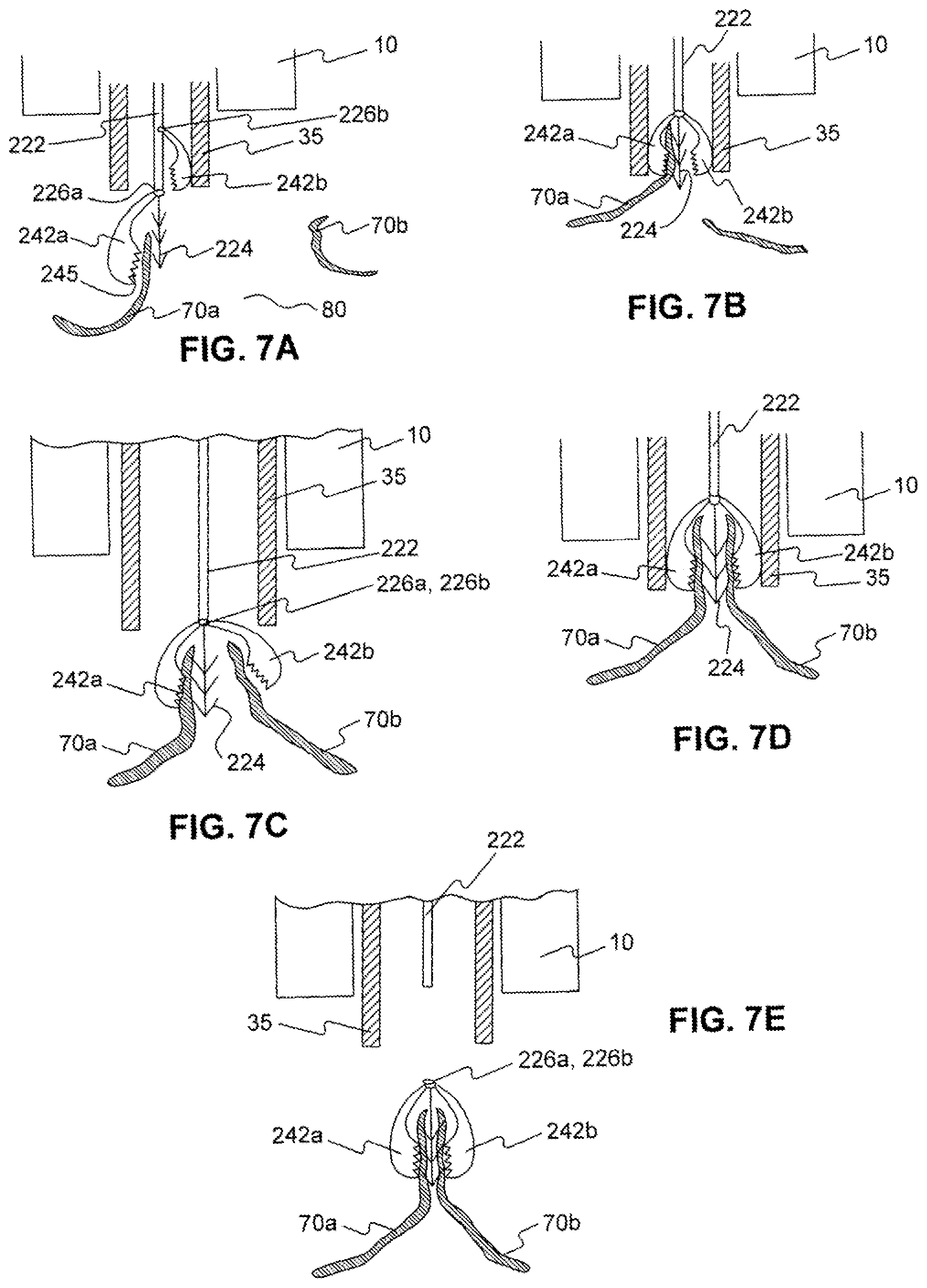 Patent US11779338 Figure 8 – Devices for approximating tissue and related