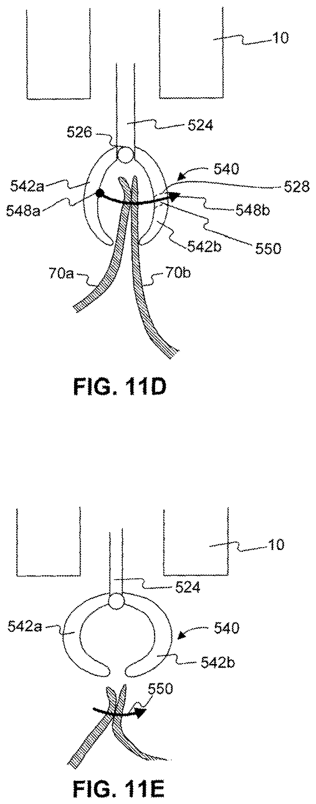 Patent US11779338 Figure 13 – Devices for approximating tissue and related