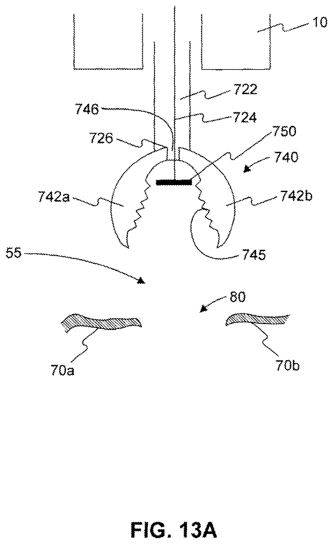 Patent US11779338 Figure 16 – Devices for approximating tissue and related