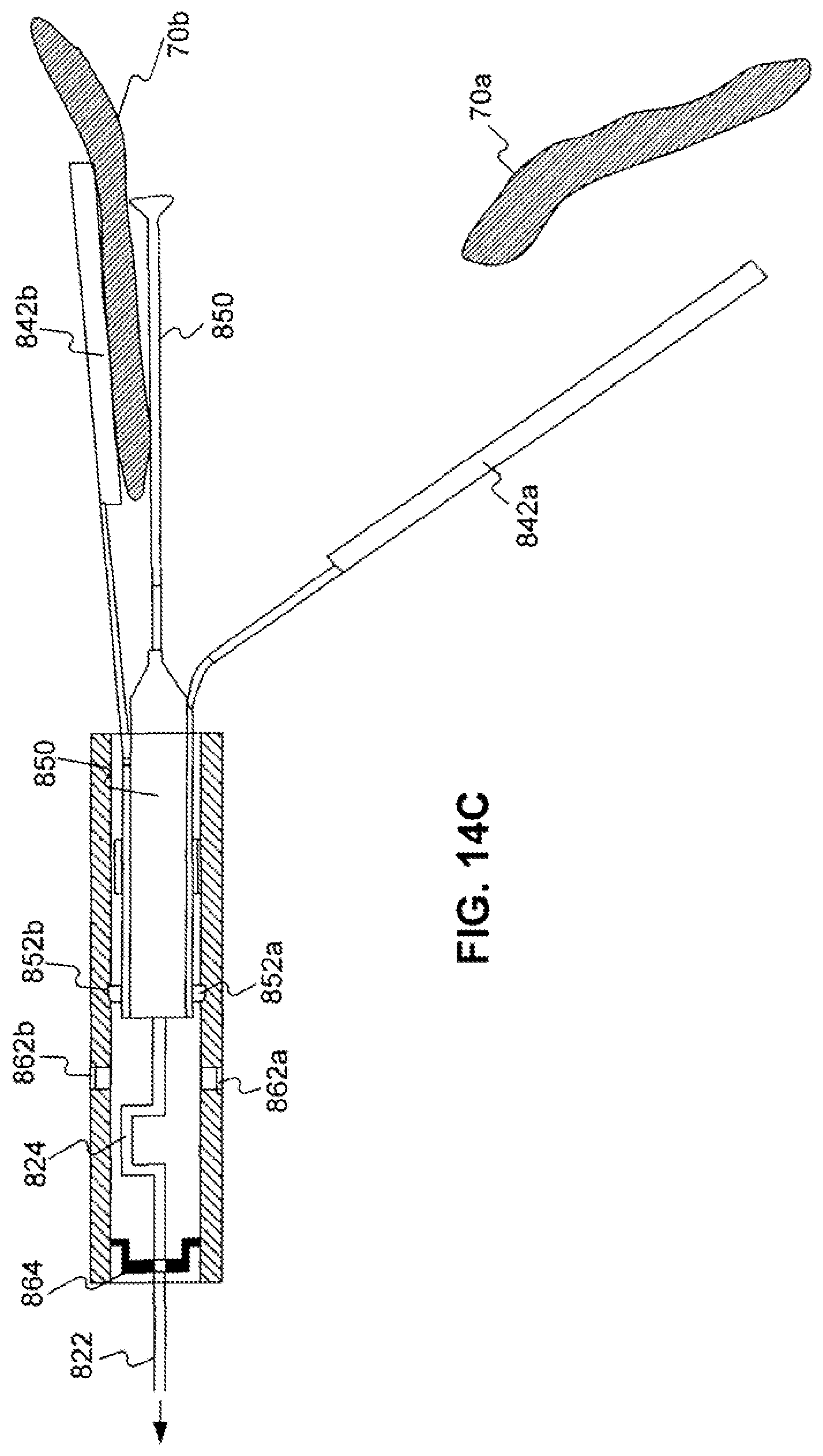 Patent US11779338 Figure 20 – Devices for approximating tissue and related