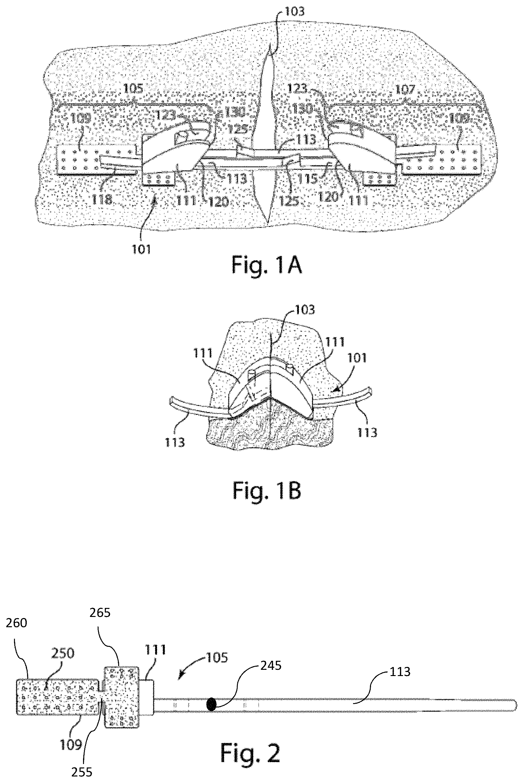 Patent US11779339 Figure 1 – Non-invasive wound closure device