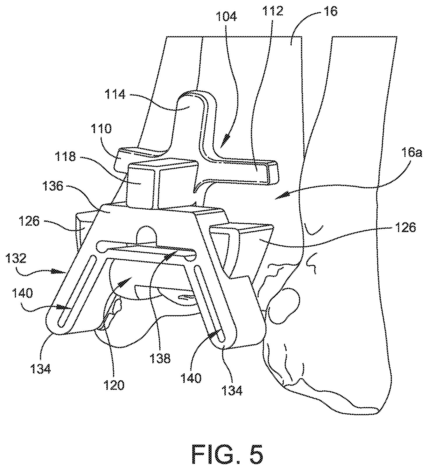 Patent US11779356 Figure 5 – Orthopedic surgical guide