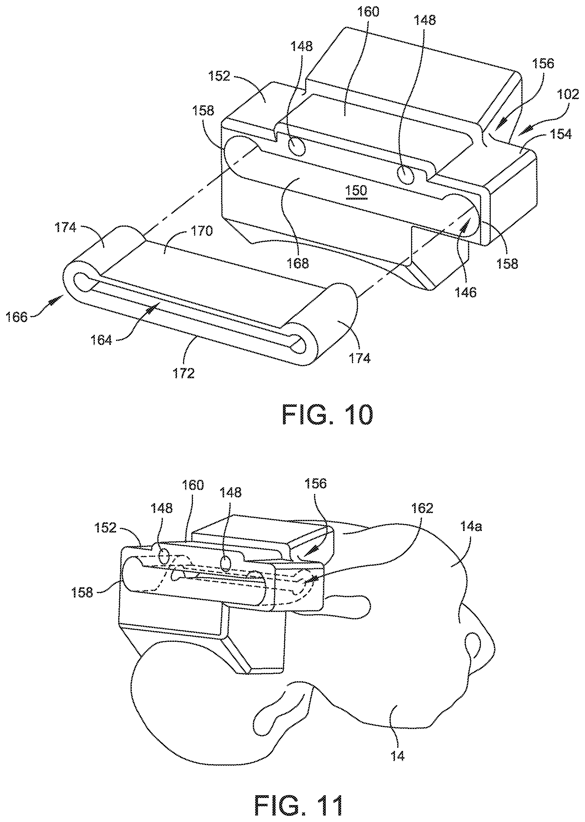 Patent US11779356 Figure 10 – Orthopedic surgical guide