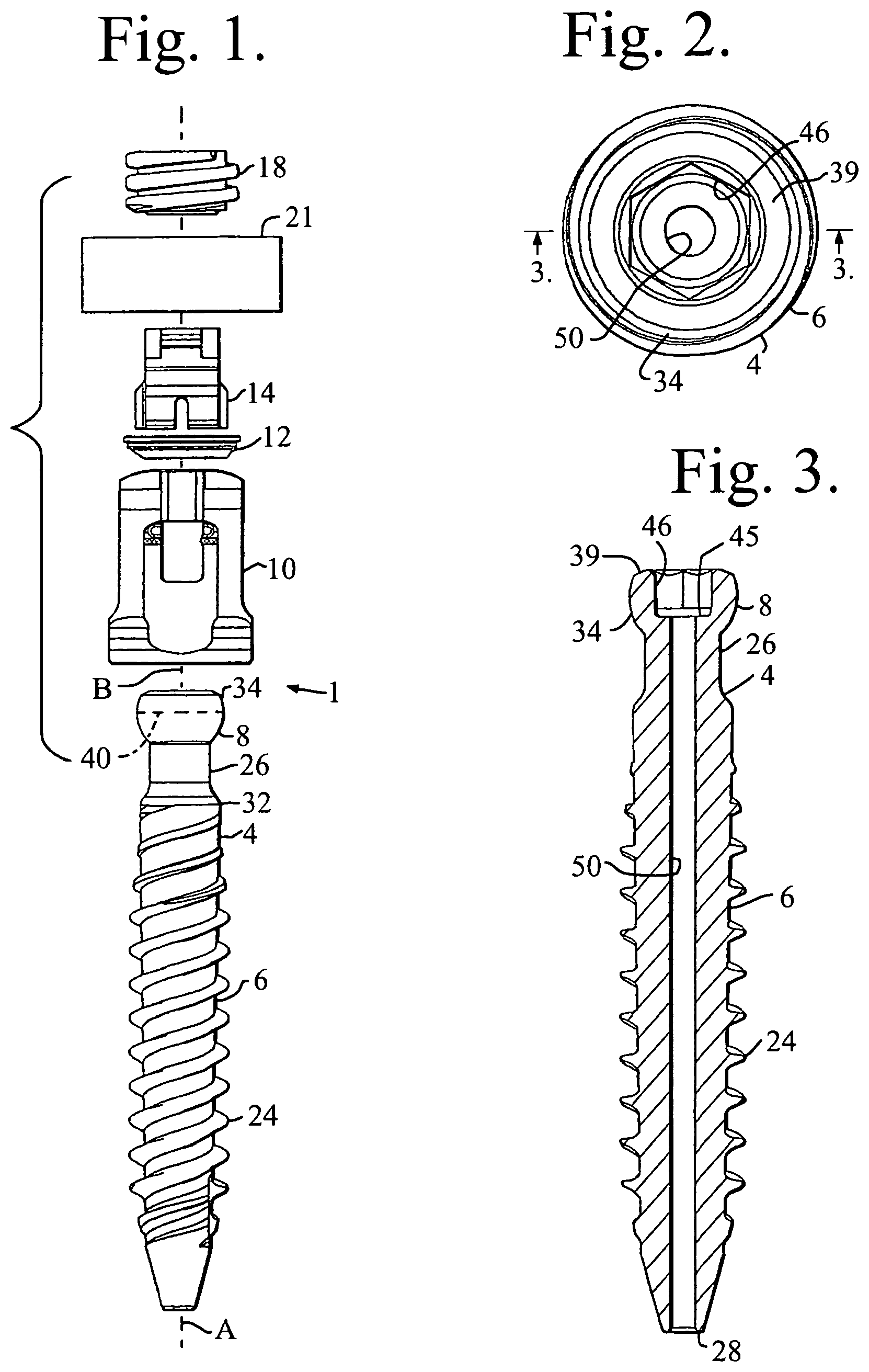 Patent US11779374 — Pivotal bone anchor assembly with non-pivoting, non-rotatable retainer — Figure 1