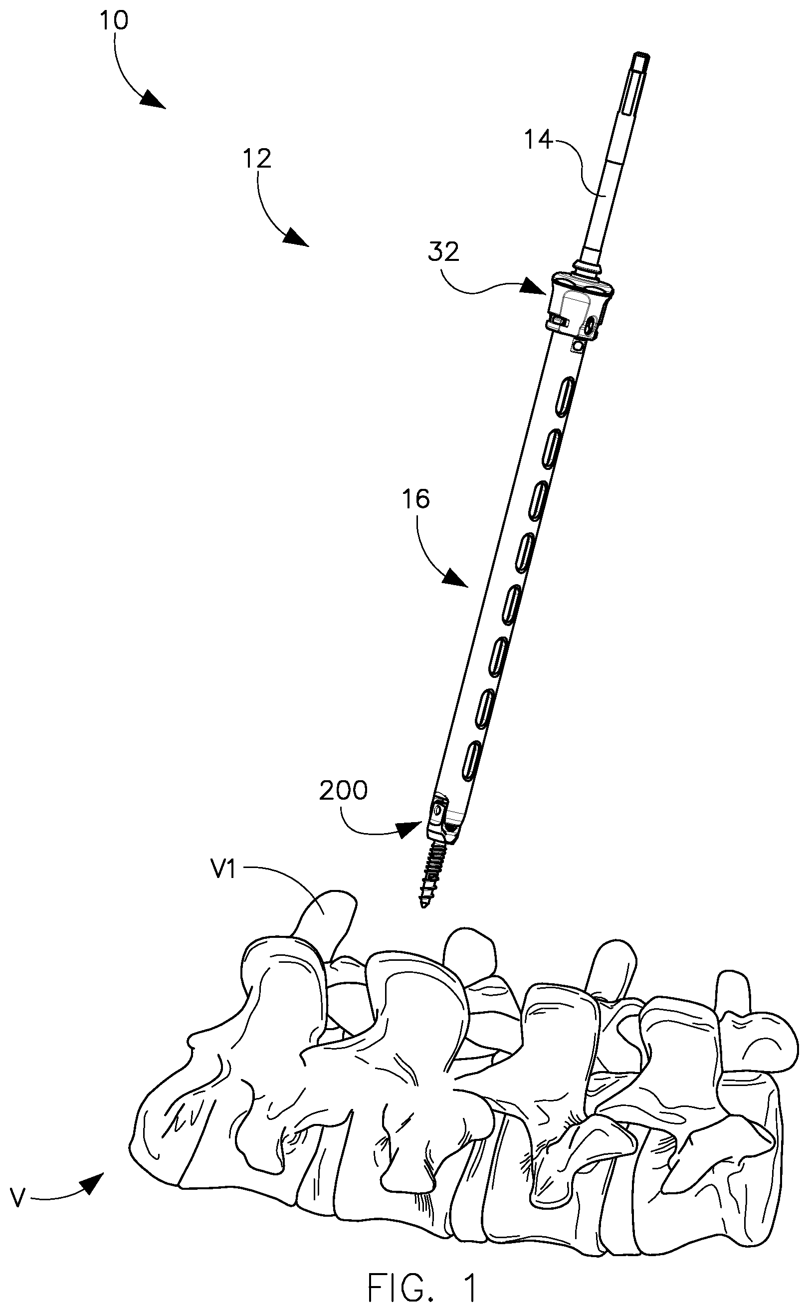 Patent US11779376 Figure 1 – Surgical instrument and method