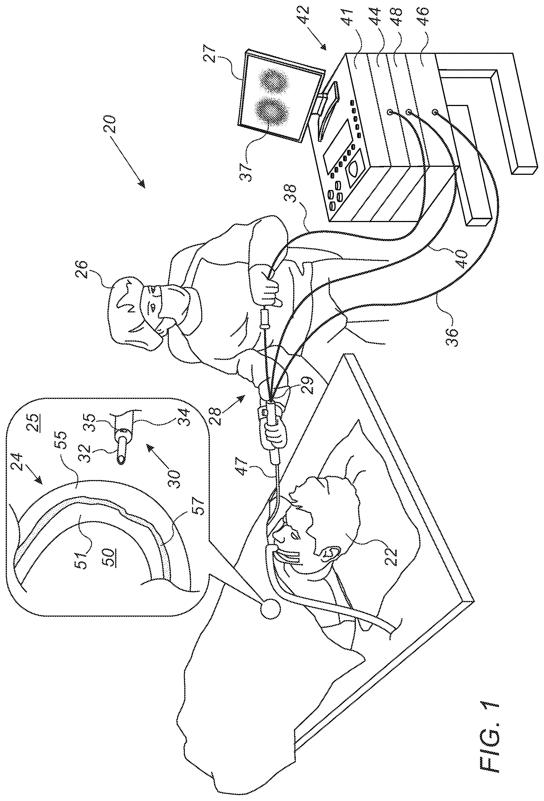 Patent US11779390 Figure 1 – Pericardium catheter including camera for guiding cutting through pericardium