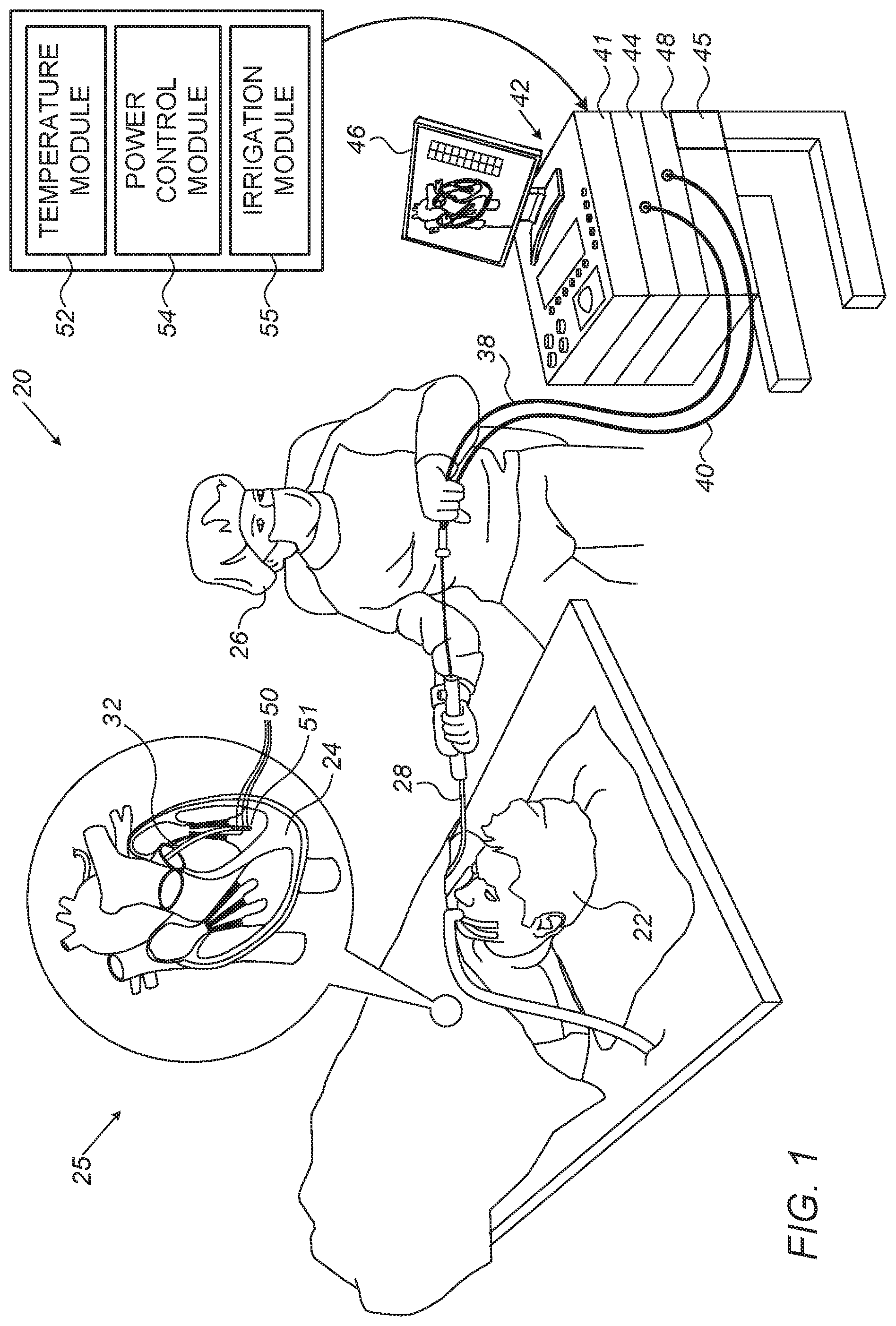 Patent US11779391 — Forming a lesion based on pre-determined amount of abaltive energy vs lesion size curve — Figure 1