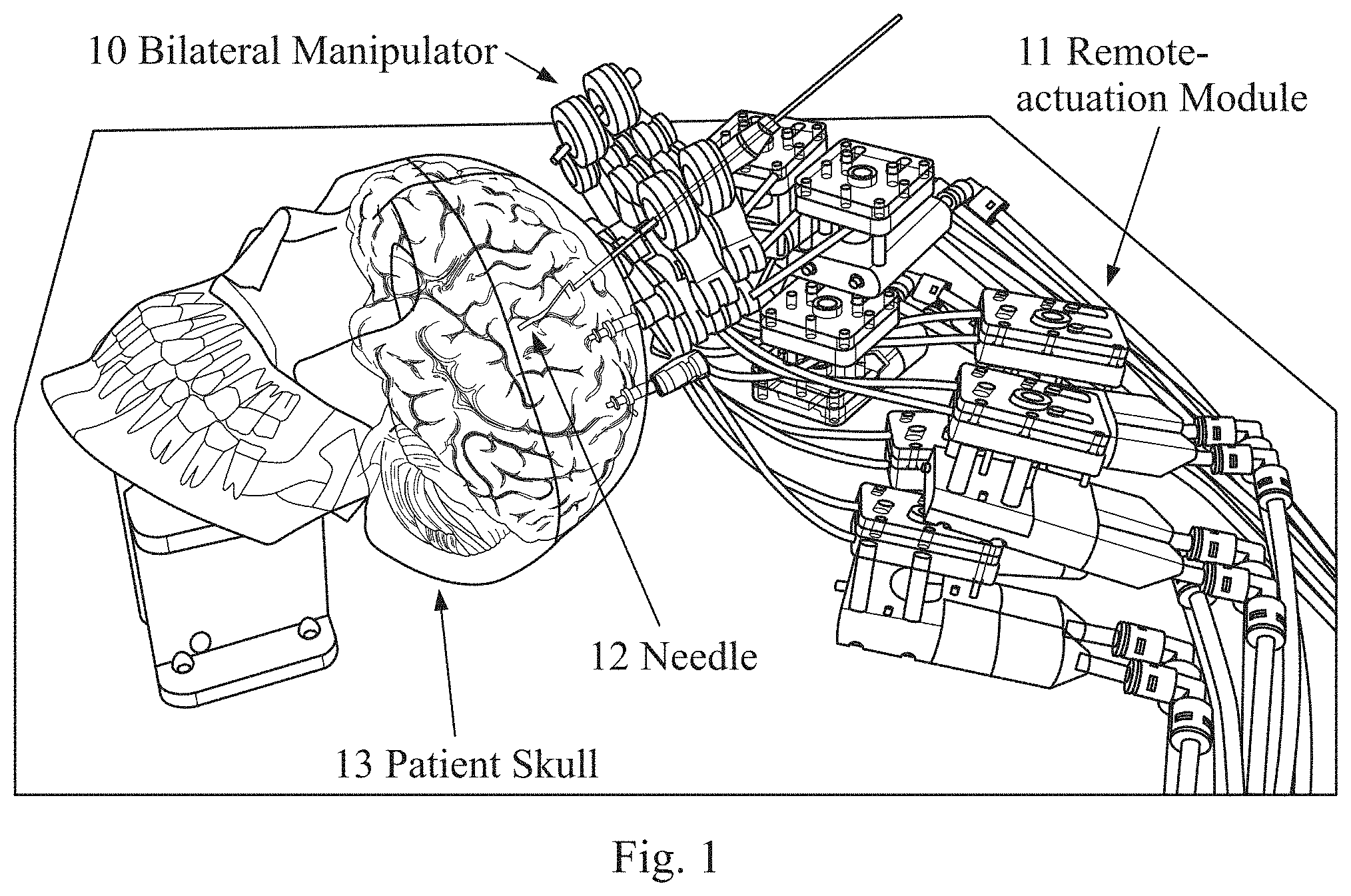 Patent US11779398 — Robotic stereotactic system for MRI-guided neurosurgery — Figure 1