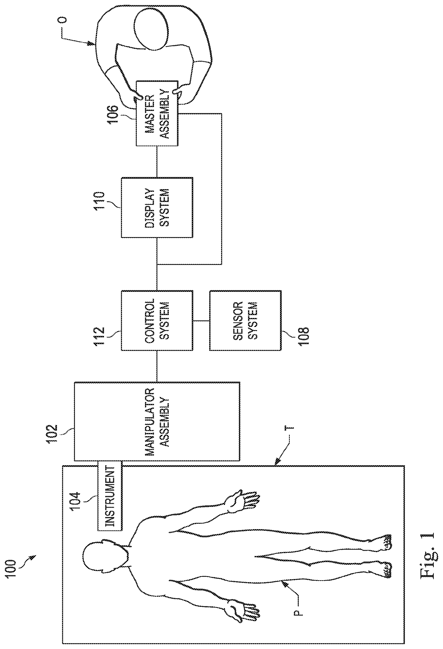 Patent US11779405 — Systems and methods for entry point localization — Figure 1