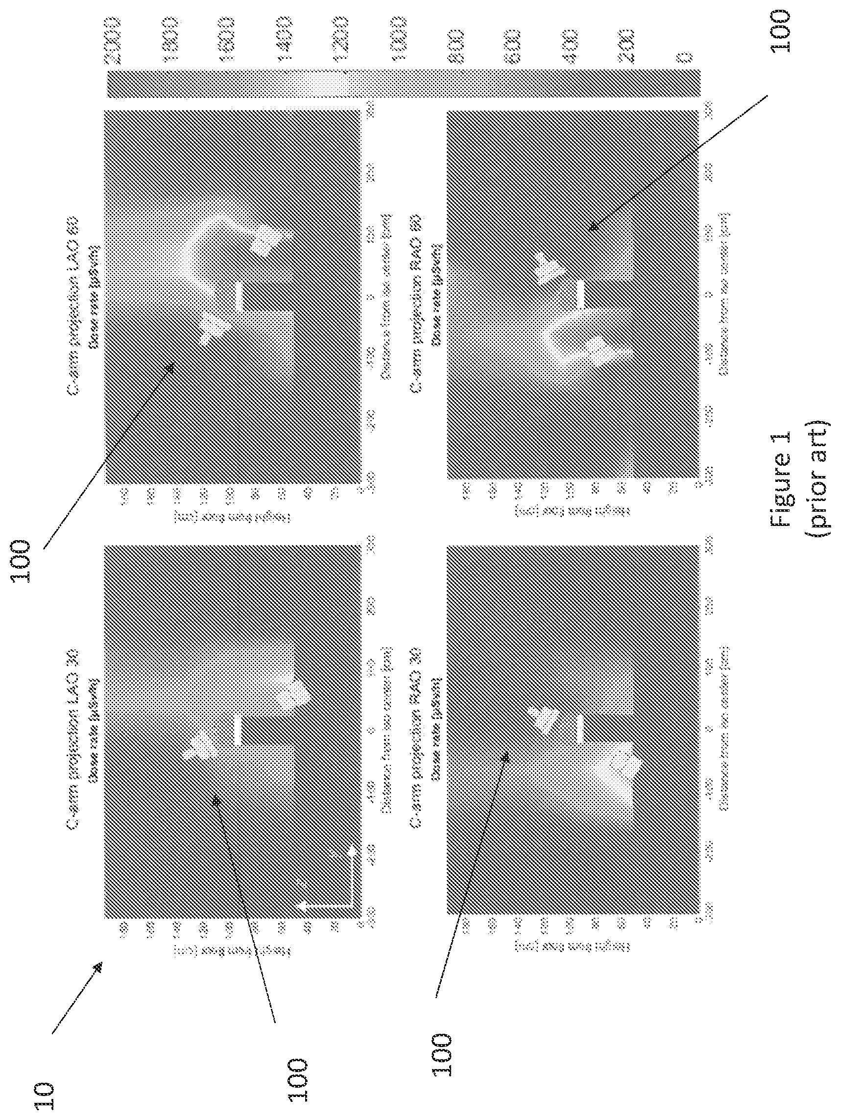 Patent US11779407 Figure 1 – Monitoring medical procedures by estimated radiation exposure
