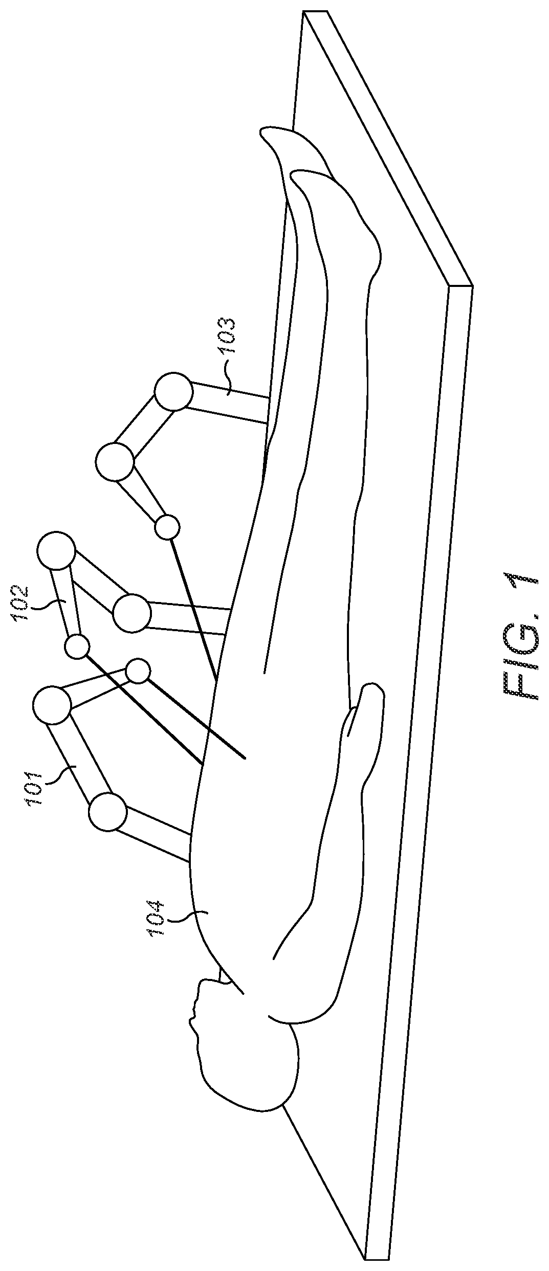 Patent US11779417 — Method of controlling a surgical robot — Figure 1