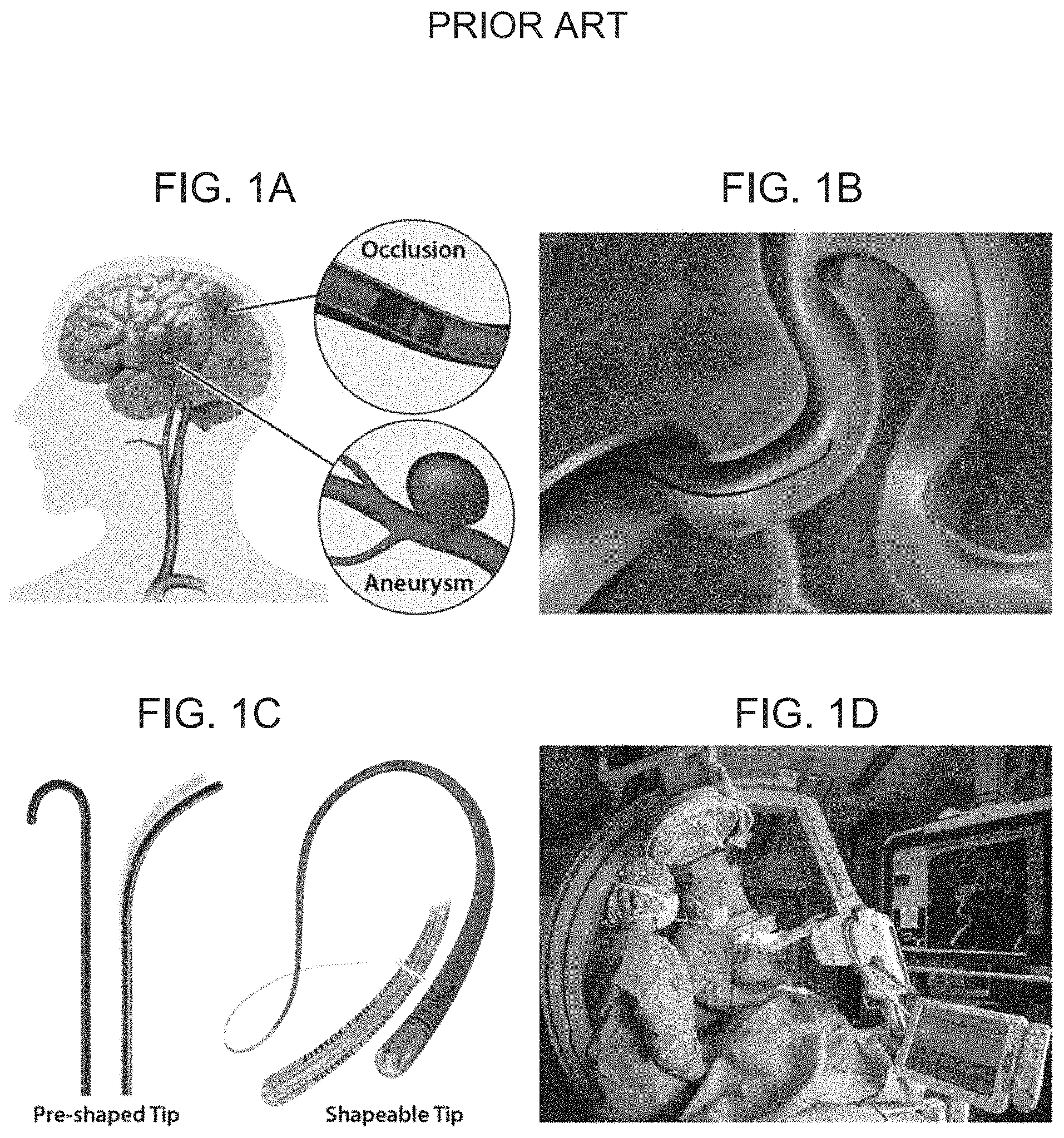 Patent US11779422 — Magnetically steerable continuum robotic guidewires for neurovascular applications — Figure 1